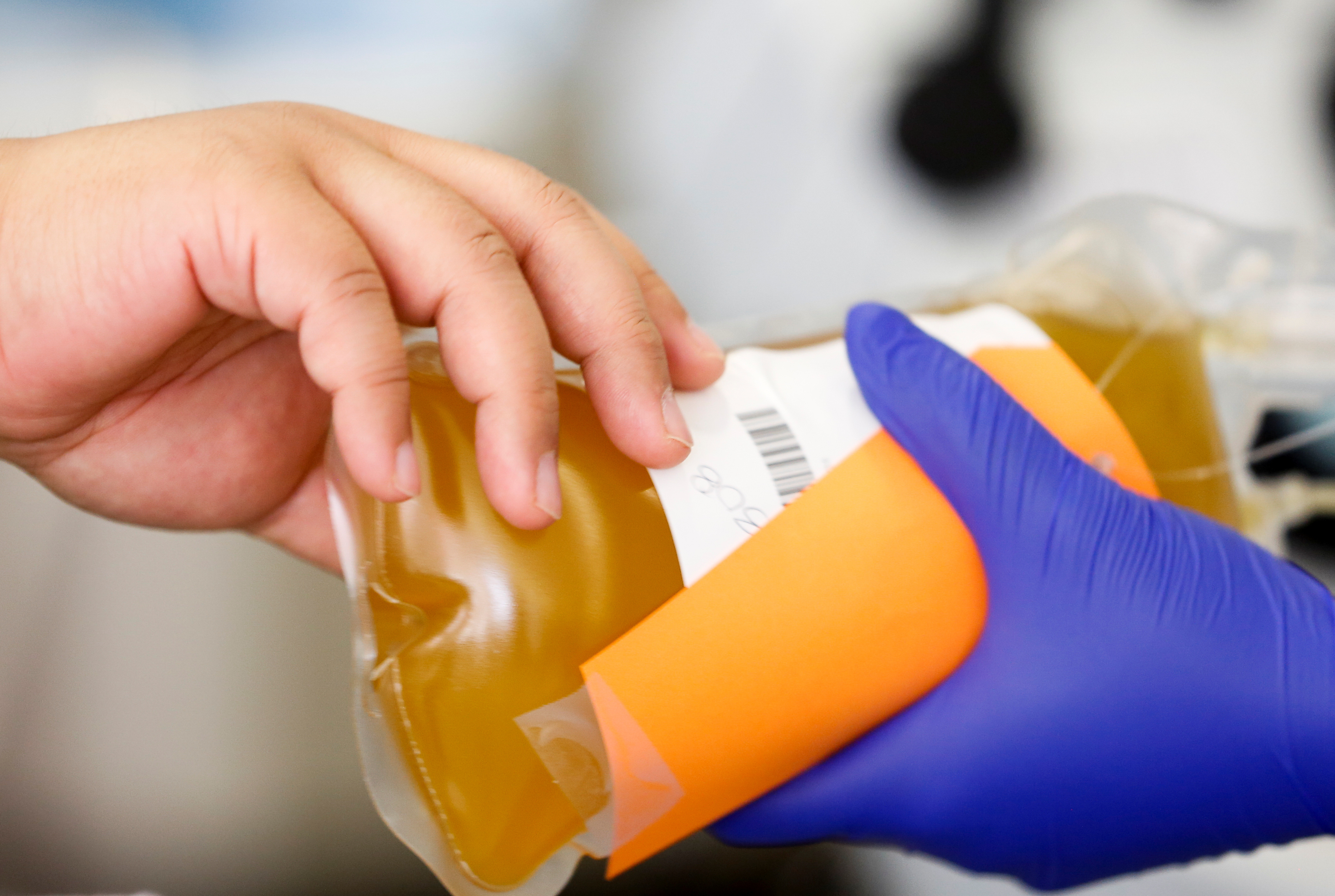 Blood plasma — the yellowish, cell-free portion that remains after red and white blood cells have been filtered out by a machine and returned to the plasma donor — is rich with antibodies. Plasma from recovered COVID-19 patients might prove useful in preventing infection as well as in treatment, scientists say. (Reuters)