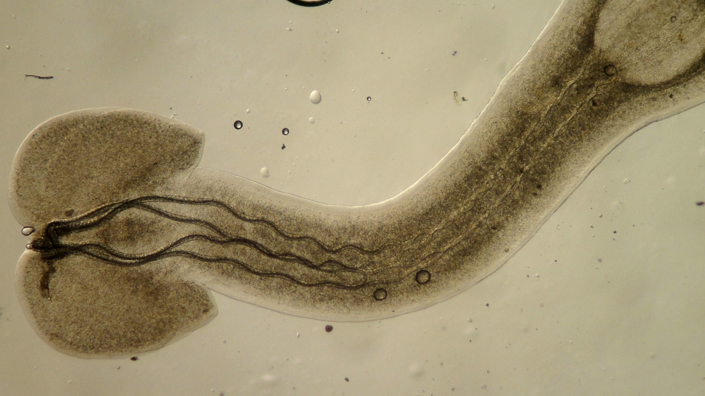 Save The Parasites : Short Wave : NPR