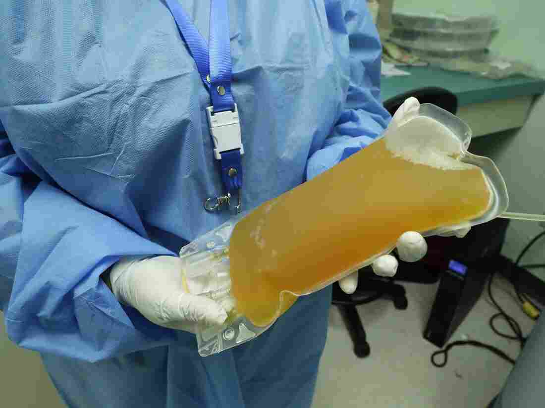 Trump Wanted FDA To Fast Track Blood Plasma Therapy. What Is It? 1 ap 20134689326971 392161511087af41a3b44036cdd40940cd01e69b s1100 c15