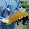 Trump Wanted FDA To Fast-Track Blood Plasma Therapy. What is it?