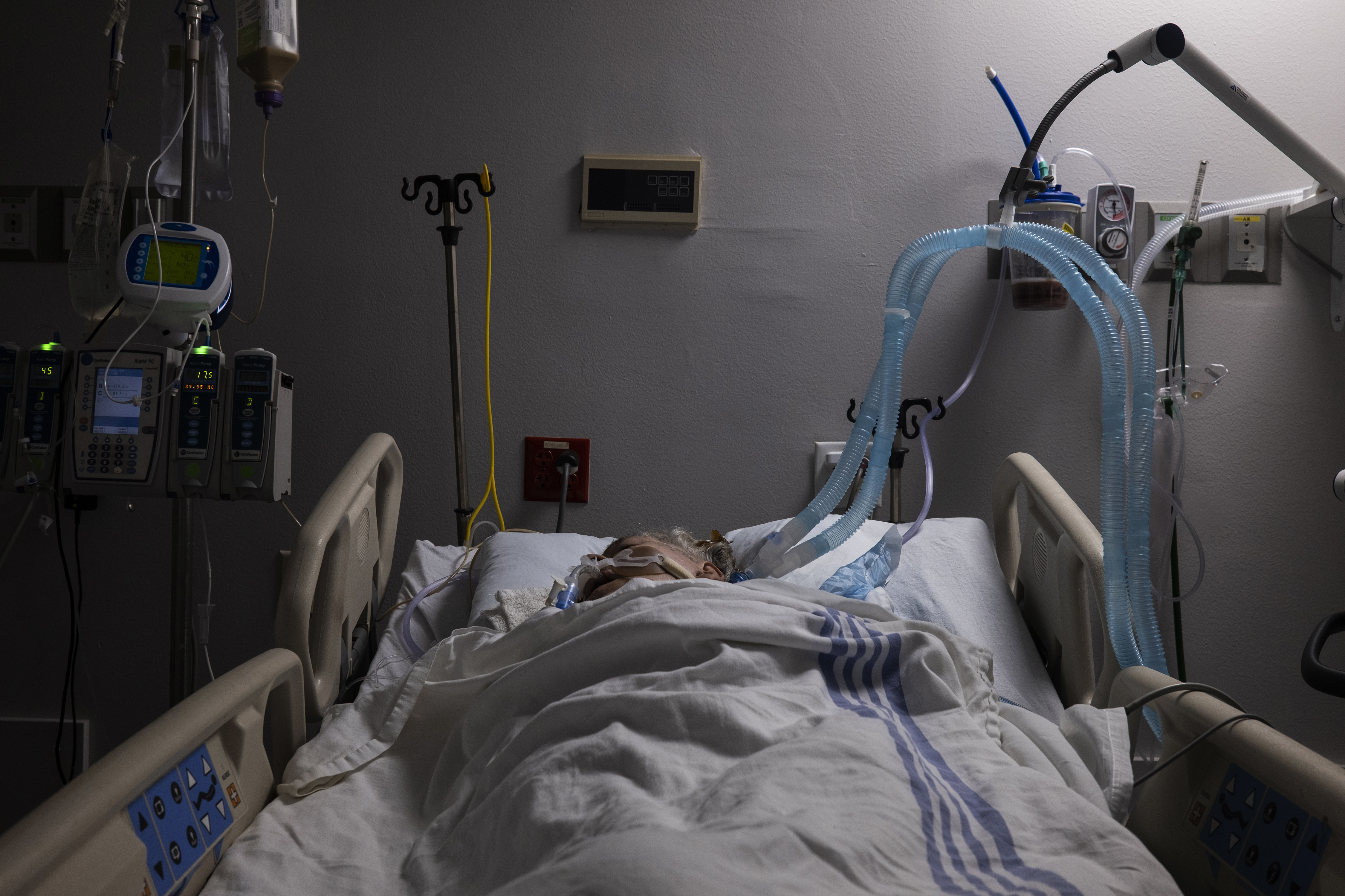 They Survived The Ventilator But Why Does Their Covid 19 Coma Persist Shots Health News Npr