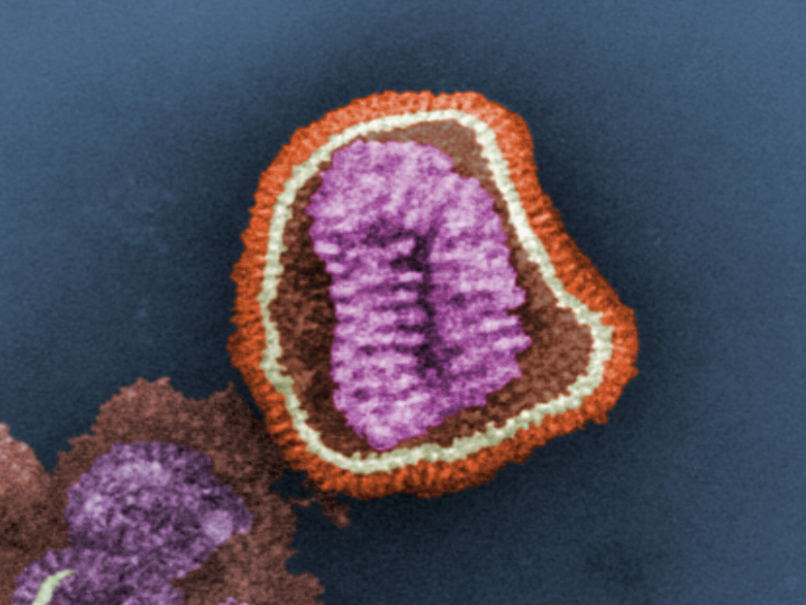 This negative-stained transmission electron micrograph depicts the ultrastructural details of an influenza virus particle, or virion. (Frederick Murphy/CDC)
