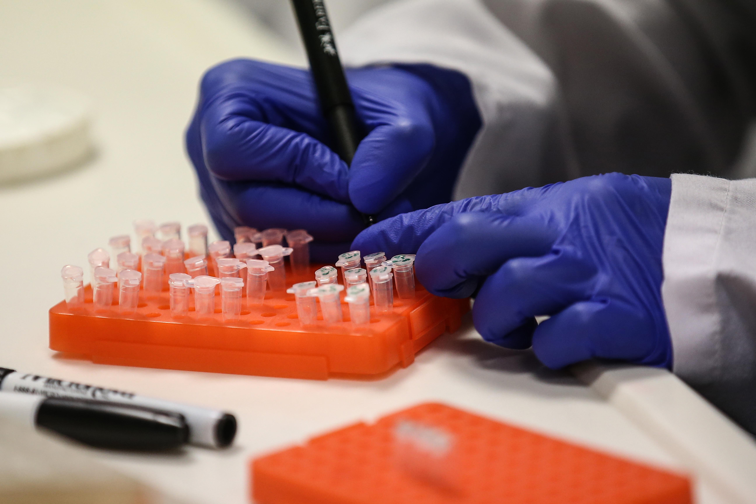 A scientist at work on a COVID-19 vaccine candidate at Bogazici University in Istanbul in August. (Anadolu Agency via Getty Images)