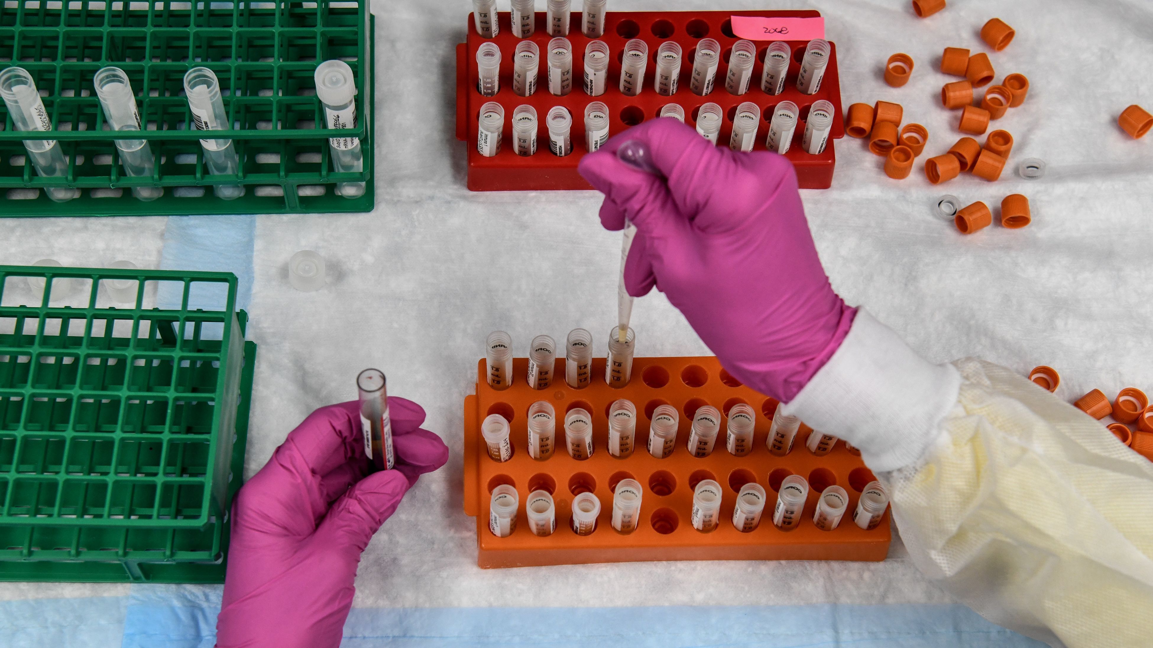 A lab technician sorts blood samples for a COVID-19 vaccination study at the Research Centers of America in Hollywood, Fla., on Aug. 13. (AFP via Getty Images)