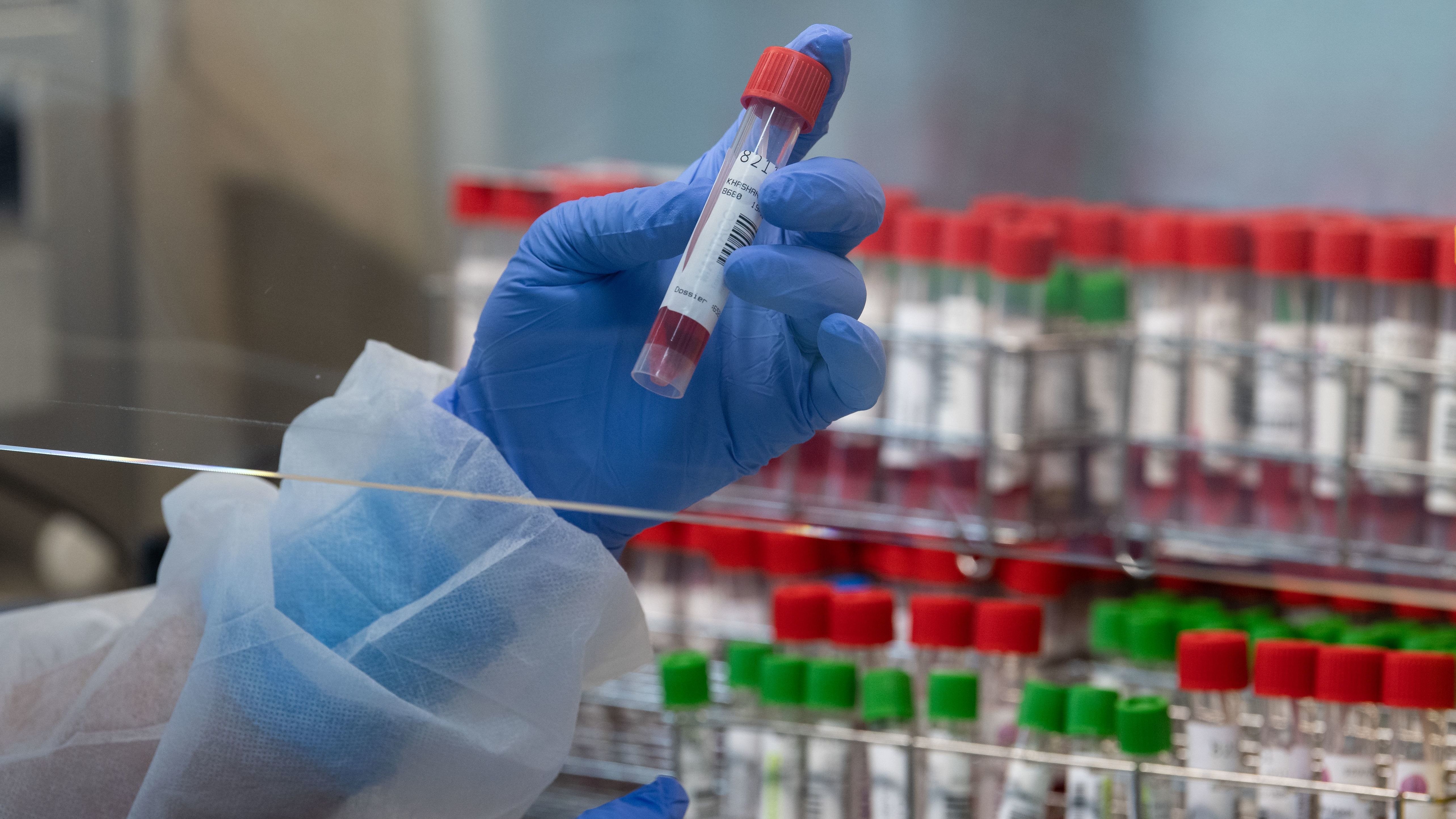 A laboratory technician is pictured handling swab samples at a hospital in Mulhouse, France, in November. French officials confirmed the country