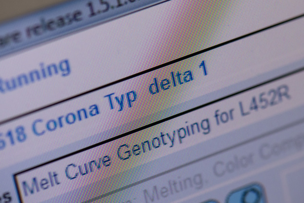 The delta variant, first detected in India, is spreading across the globe. In parts of the U.S., the strain accounts for more than 80% of new infections, according to CDC estimates.