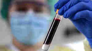 New Evidence Points To Antibodies As A Reliable Indicator Of Vaccine Protection