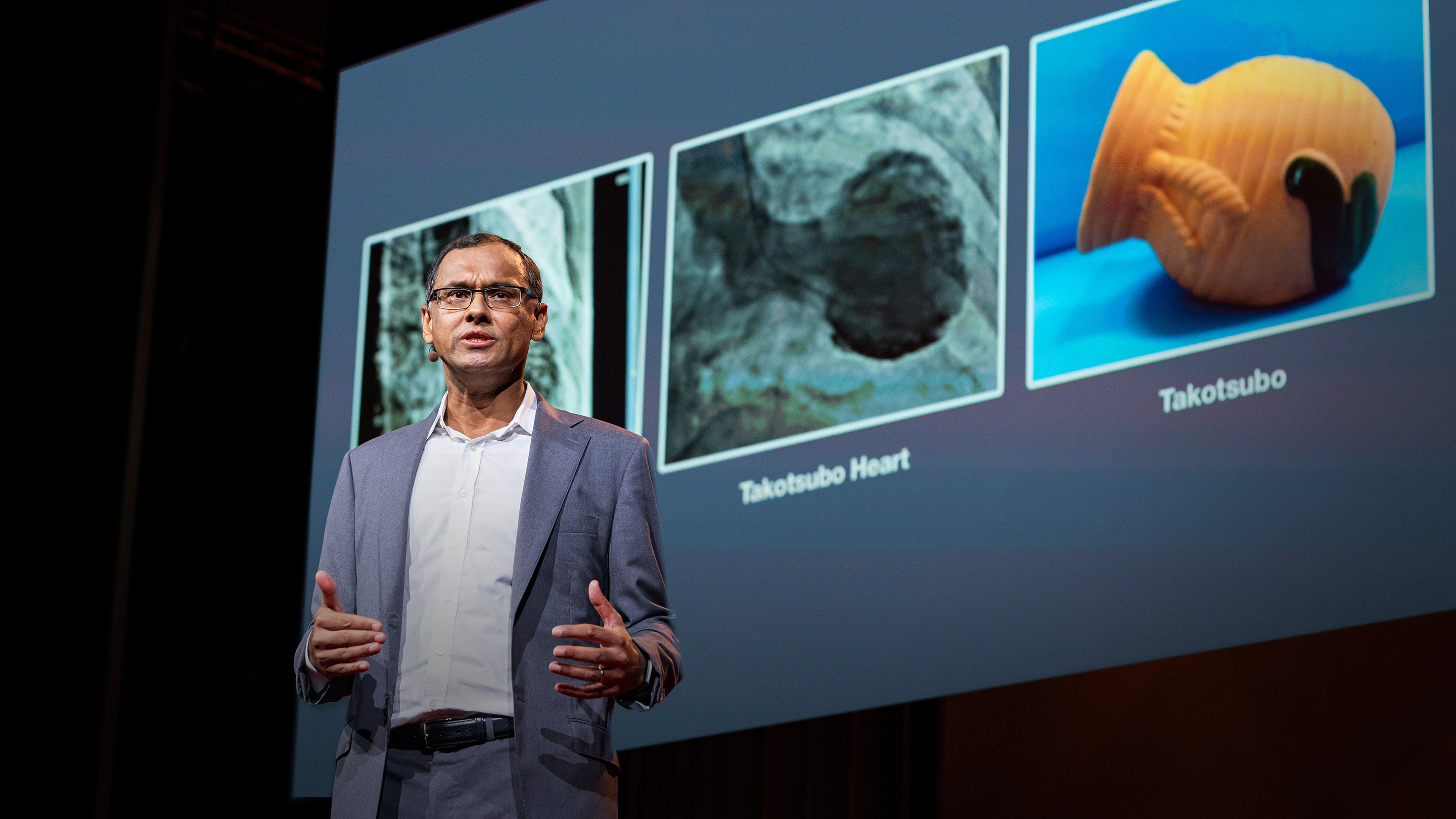Sandeep Jauhar: How do emotions affect the heart? - Vimarsana News