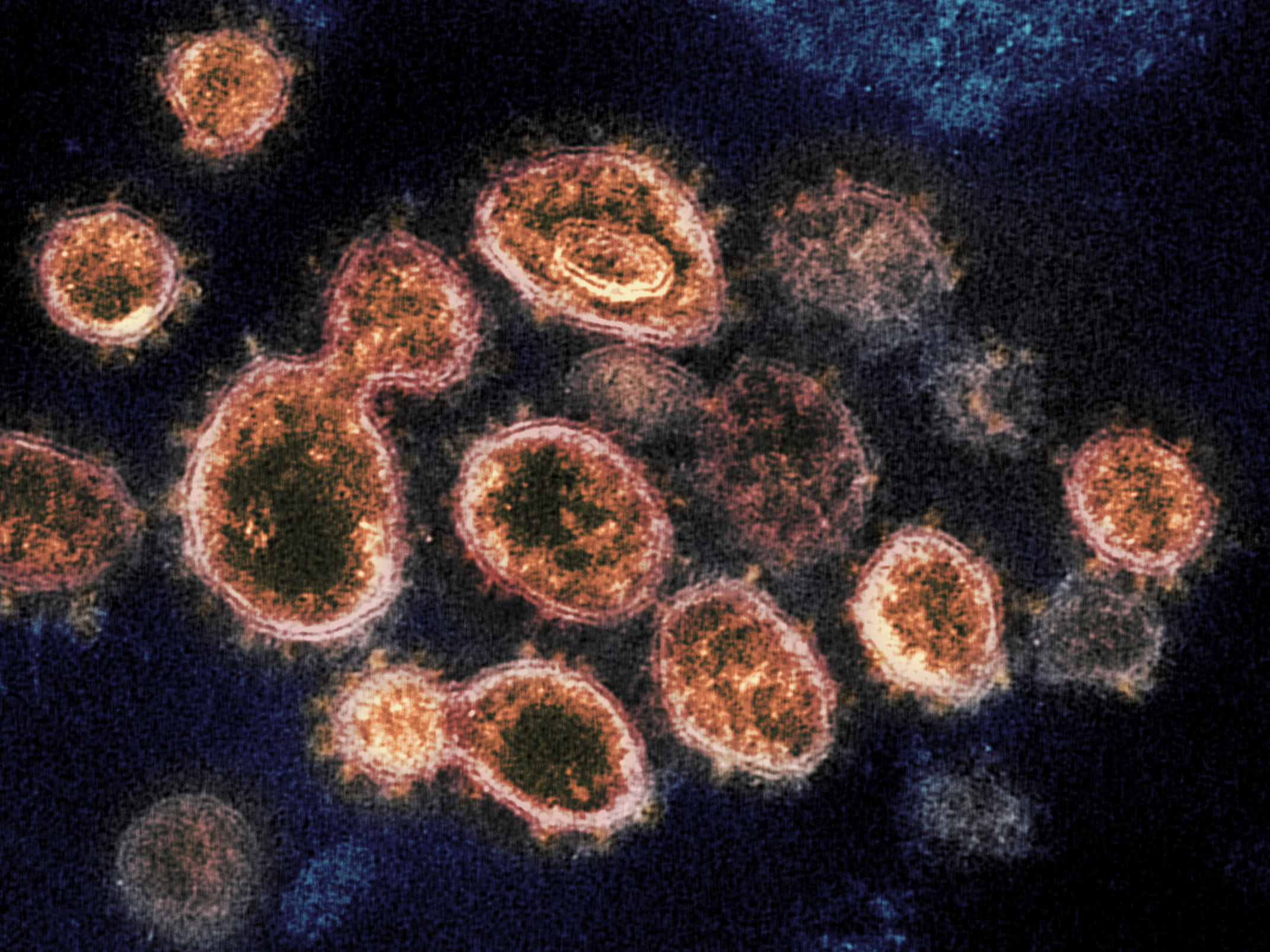 Cost Of Metformin In Ontario