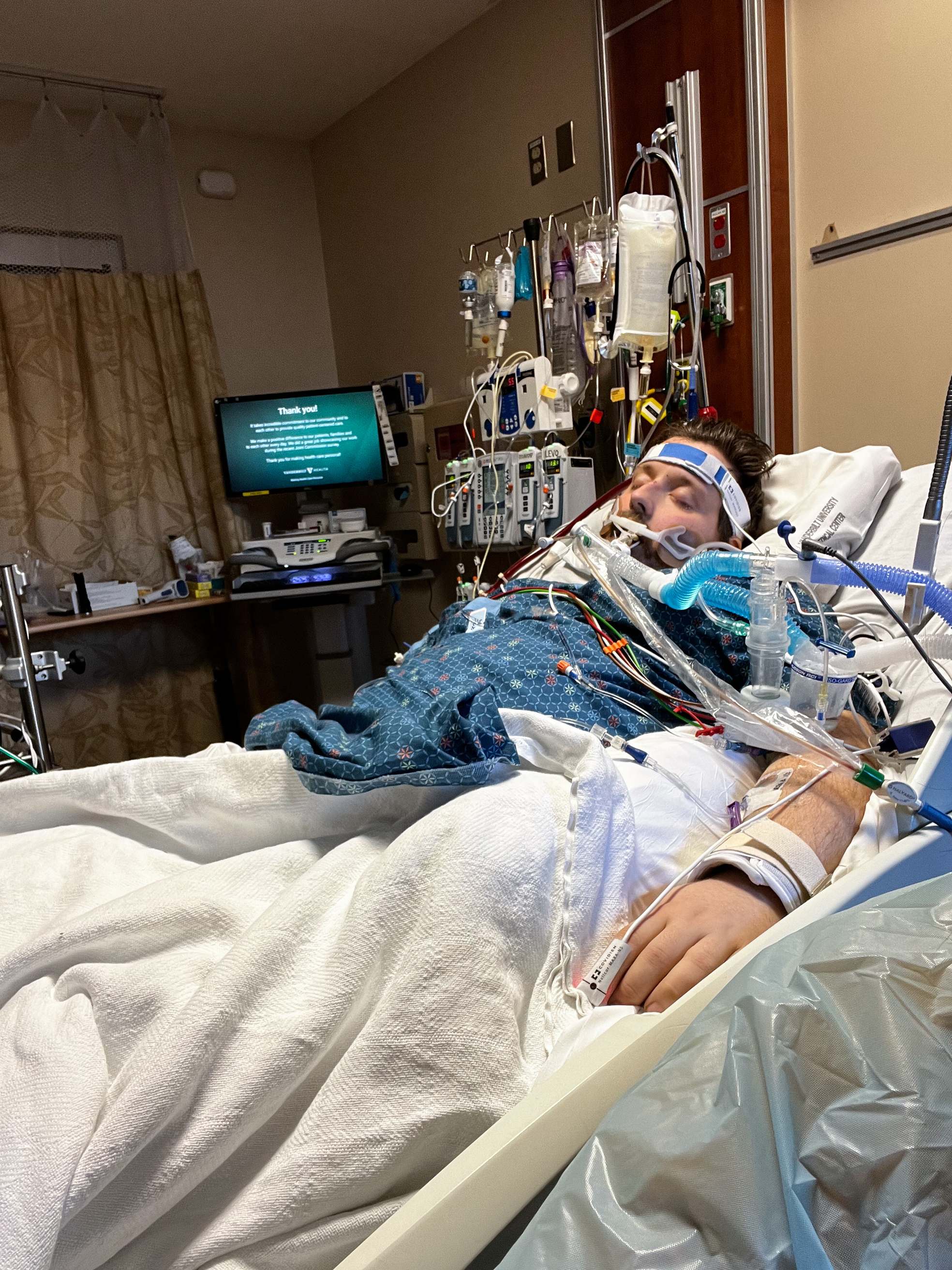 Emcmo Machine Even with risky survival rate, shortages of ECMO machines cost lives ...