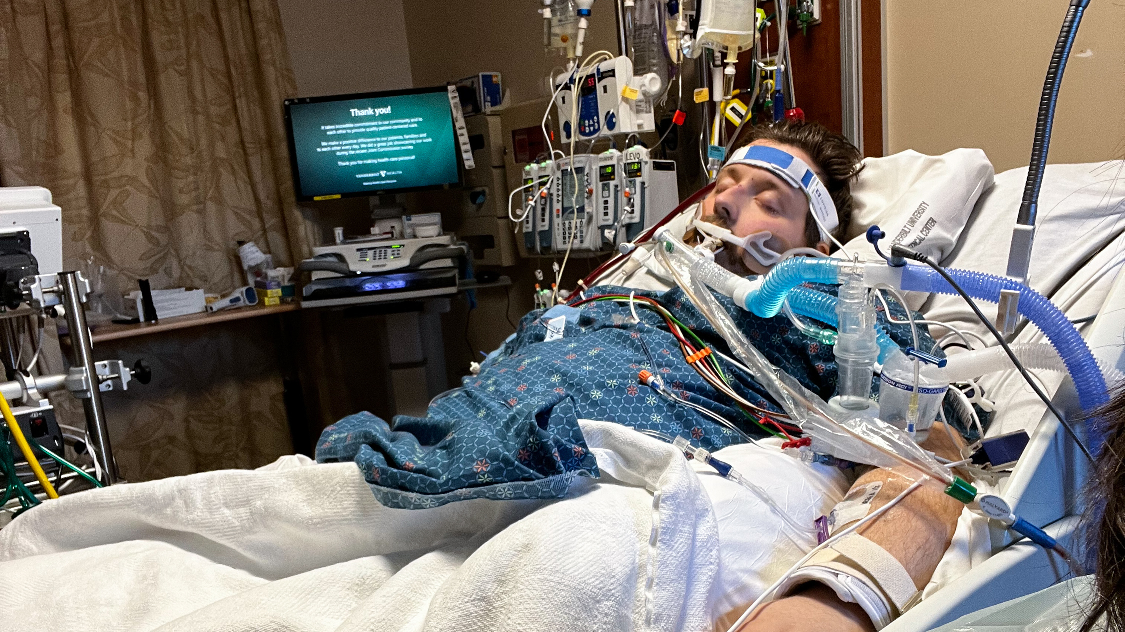 ECMO machine shortages cost lives, study finds Shots Health News NPR