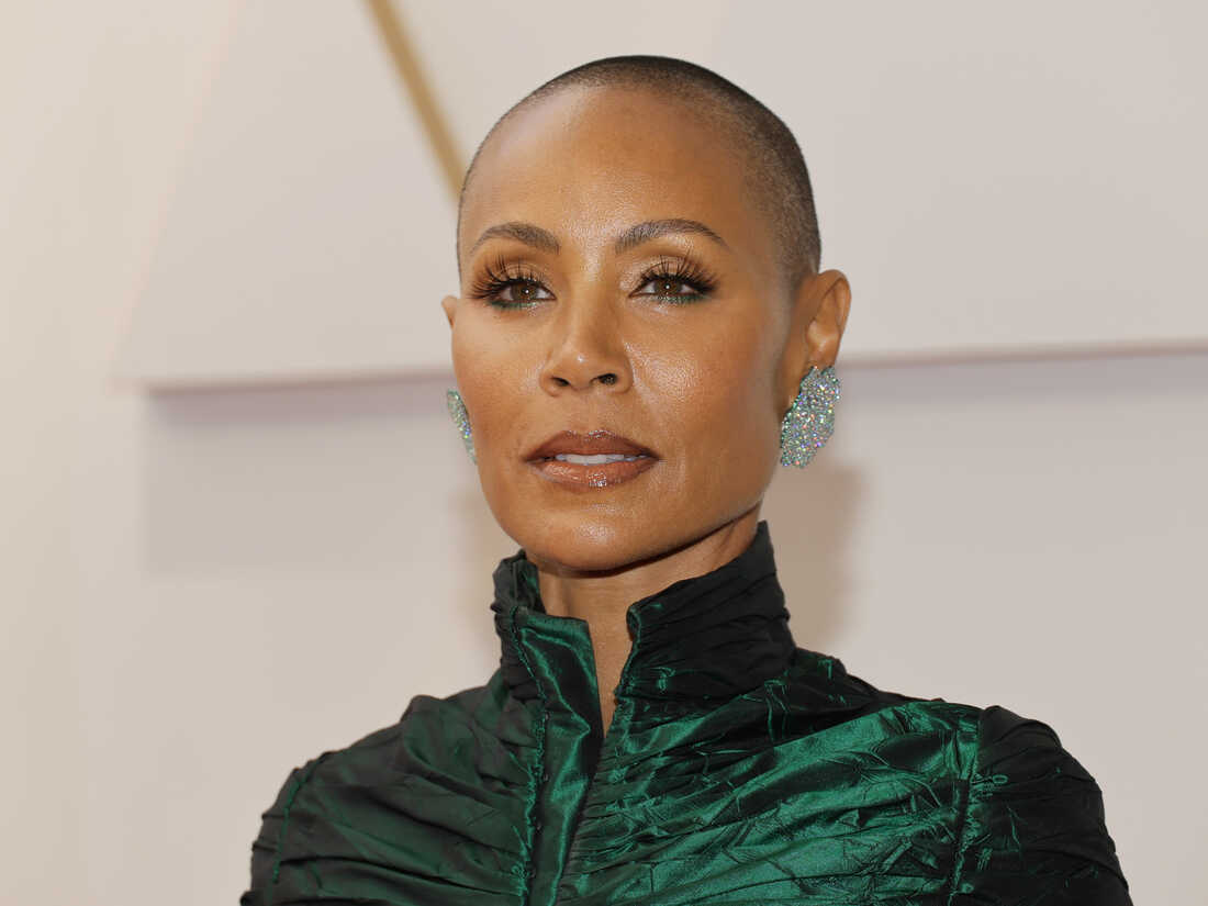 Jada Pinkett Smith and Alopecia: What to Know After 2022 Oscars