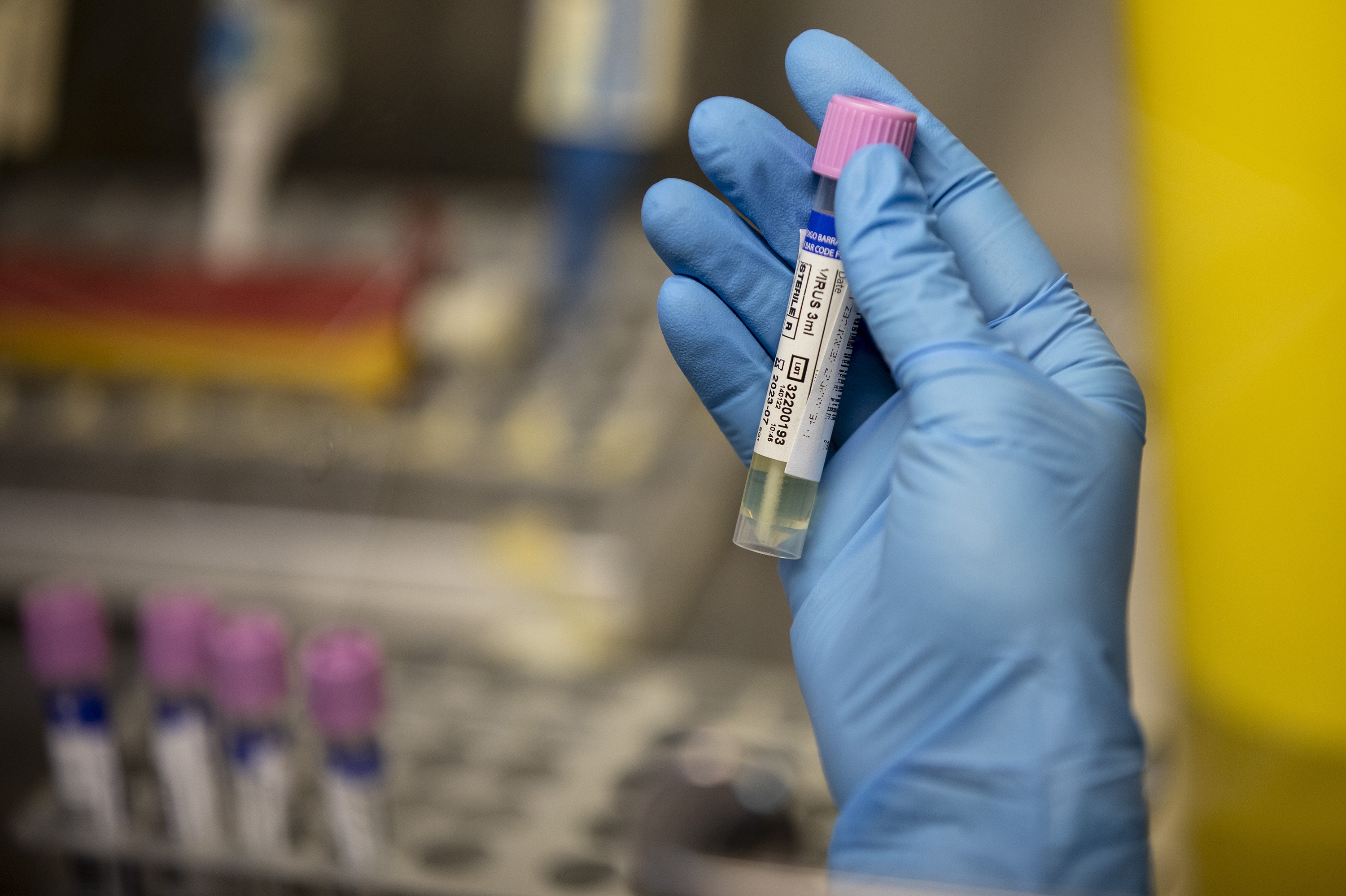Oregon faces 'another public health emergency' as monkeypox begins to spread - Vimarsana News