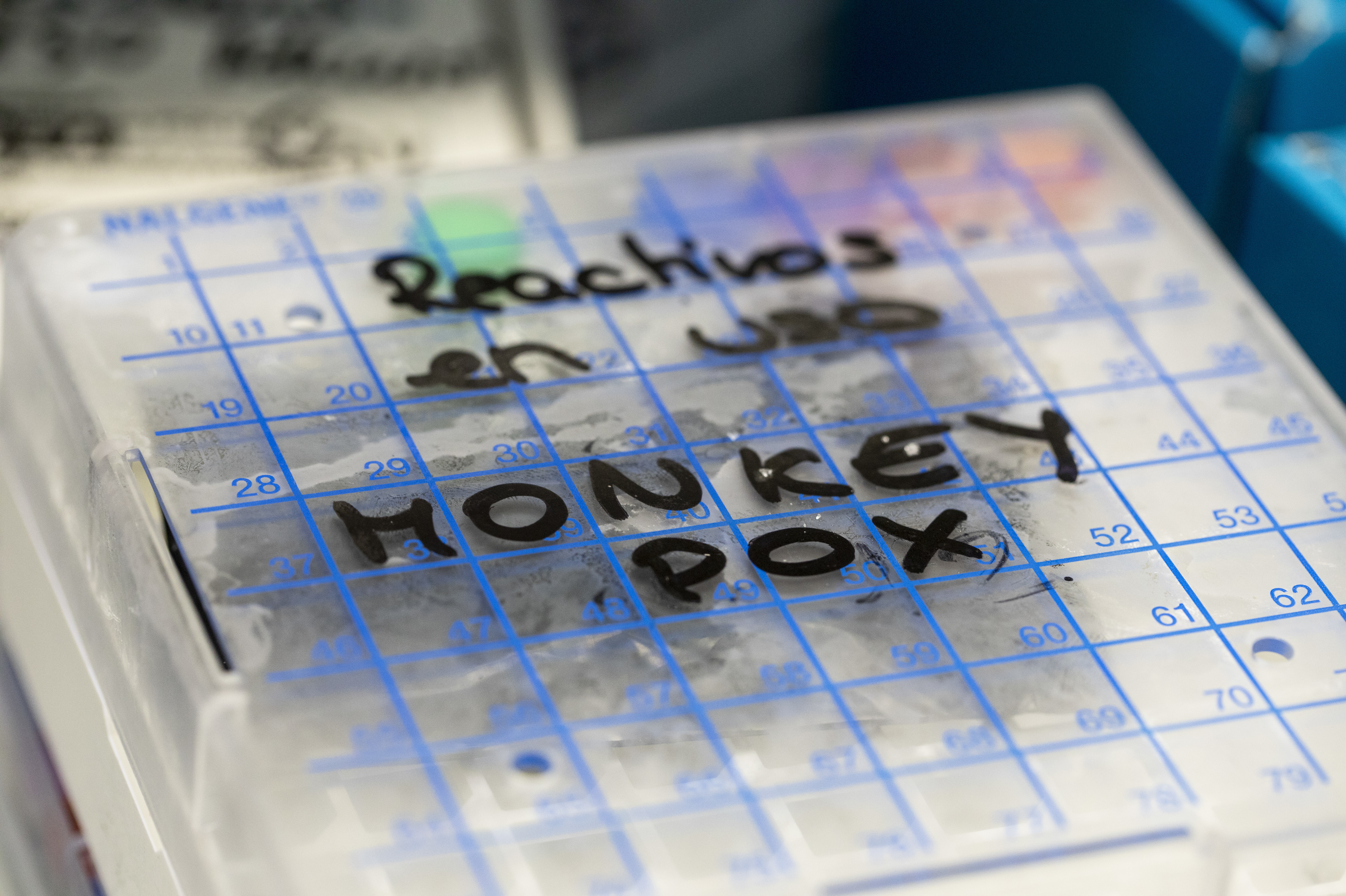 A reactive to test suspected monkeypox samples is seen inside a fridge at the microbiology laboratory of La Paz Hospital on June 06, 2022 in Madrid, Spain. Europe is at the centre of the monkeypox virus outbreak, the World Health Organization reported 780 confirmed cases with Britain, Spain and Portugal reporting the largest numbers of patients. (Getty Images)