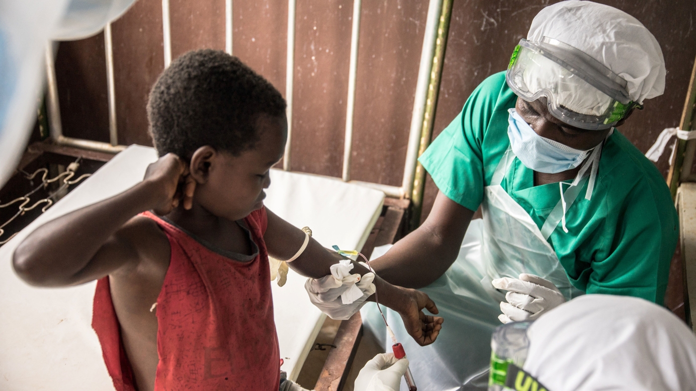 Monkeypox outbreak was avoidable and we ignored the warning signs