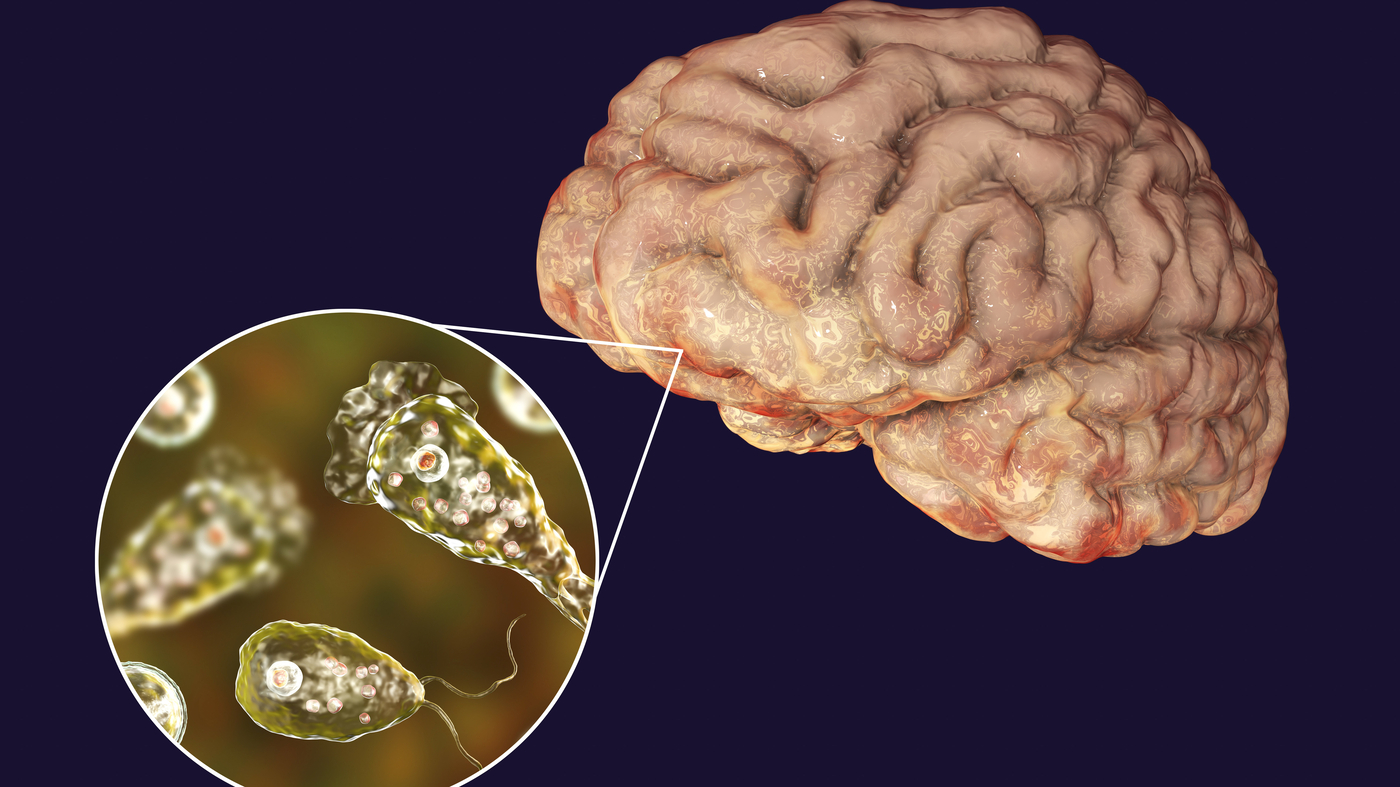 Naegleria fowleri (Beyin yeyən amoeba)