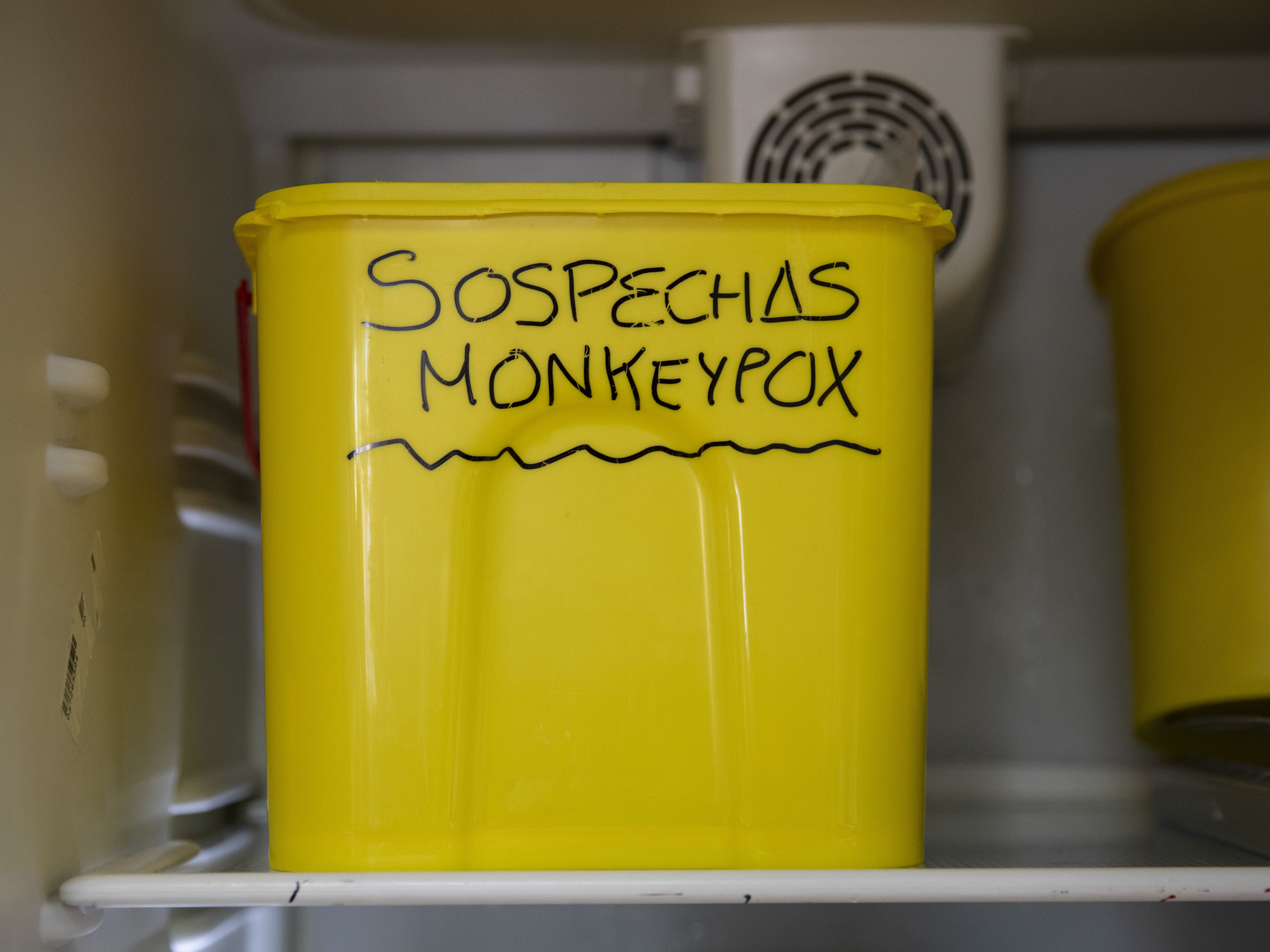 A bucket with suspected monkeypox samples is stored at a laboratory in Spain in June. (Getty Images)