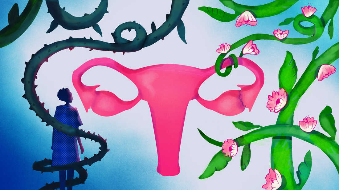 Worried about future access to abortion, more women are asking to get their "tubes tied," doctors say. But there are a lot of barriers to actually getting this procedure.