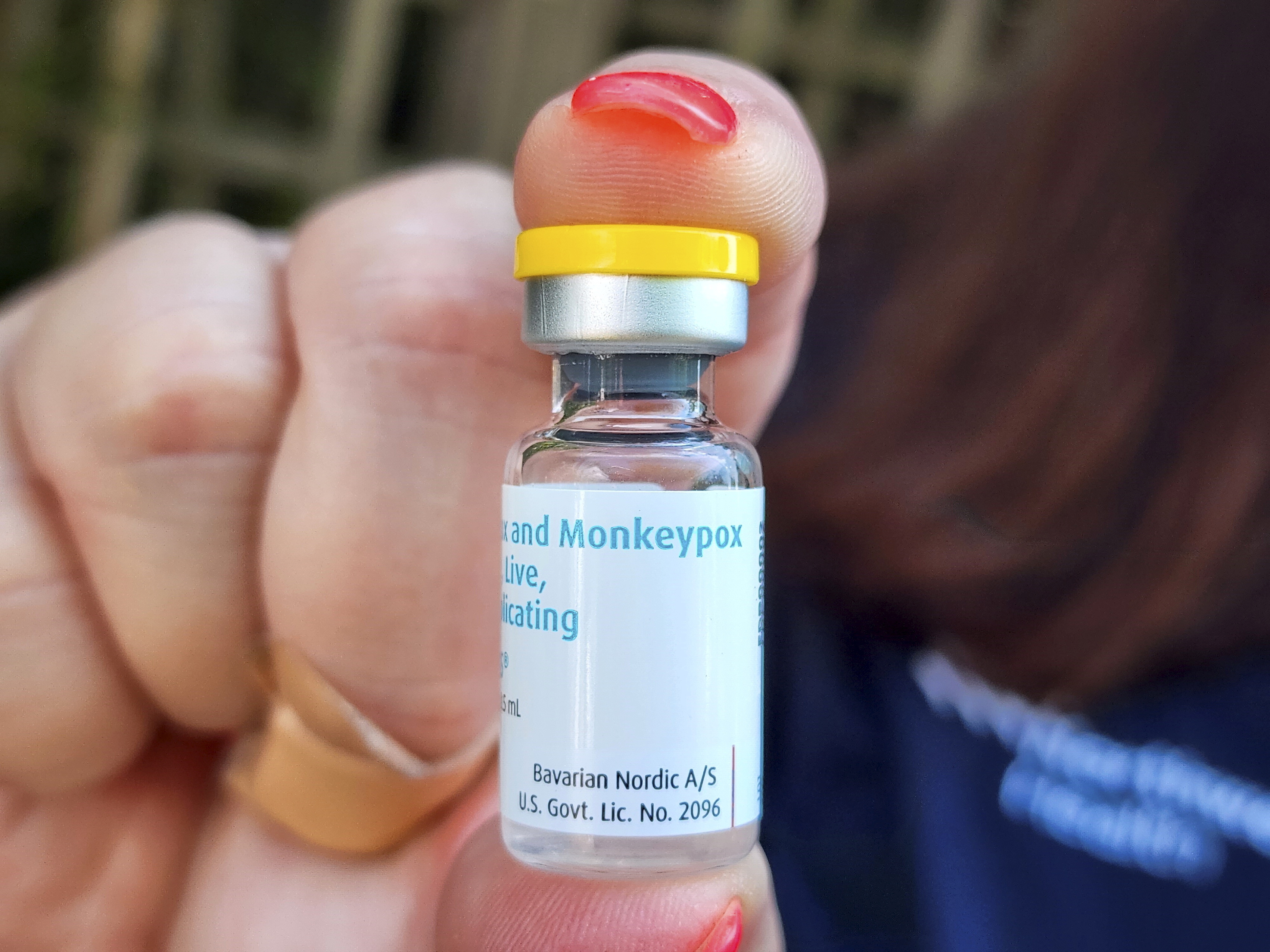 Fire Island, N.Y.: A vial of the Monkeypox vaccine is displayed by a medical professional at vaccination site at the Northwell Health offices at Cherry Grove on Fire Island, New York on July 13, 2022. (Newsday via Getty Images)