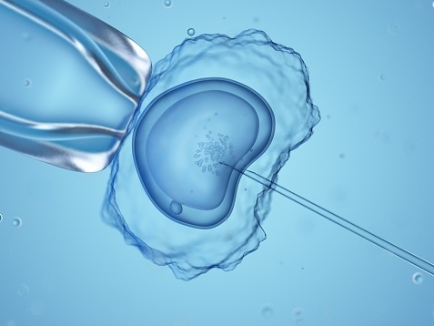 In states that outlaw abortion, some patients and health care workers worry that in vitro fertilization could be in legal jeopardy too. (Getty Images/Science Photo Library)