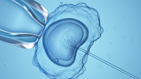 Infertility patients fear abortion bans could affect access to IVF treatment Infertility patients fear abortion bans could affect access to IVF treatment