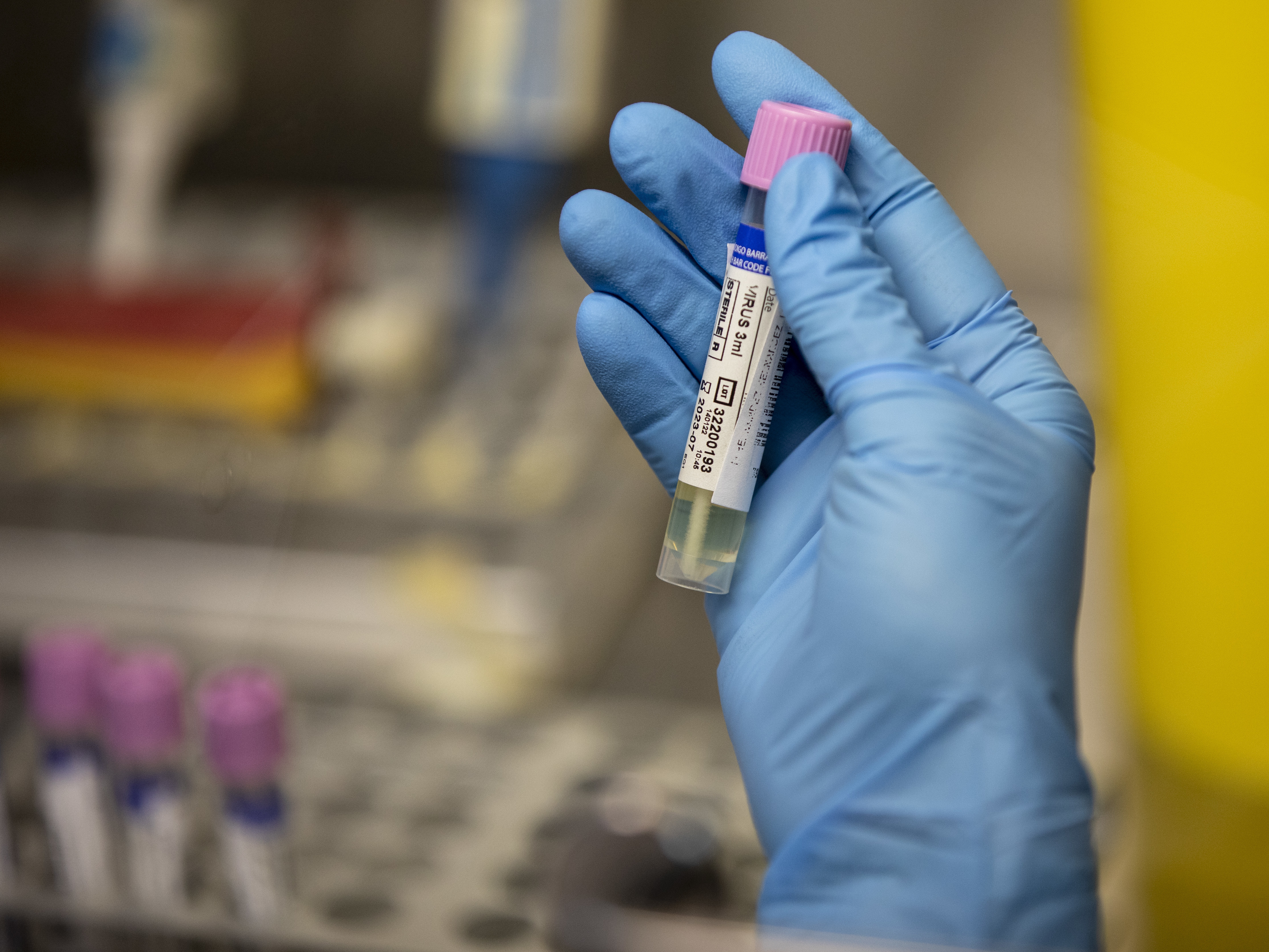 Testing capacity for monkeypox is being rapidly expanded. (Getty Images)