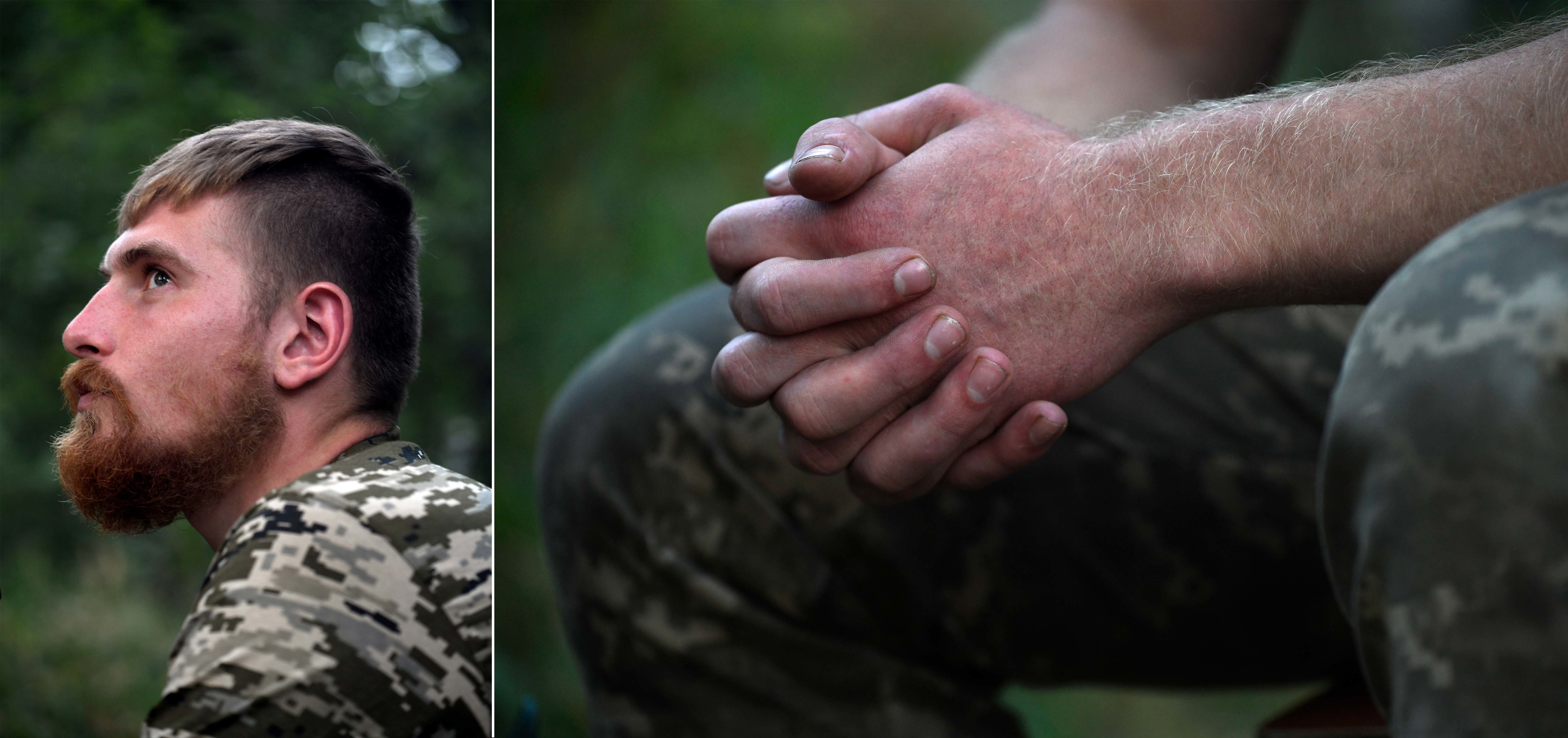 As Ukraine S War Grinds On Soldiers Are Outgunned And Injuries Are Rising Npr