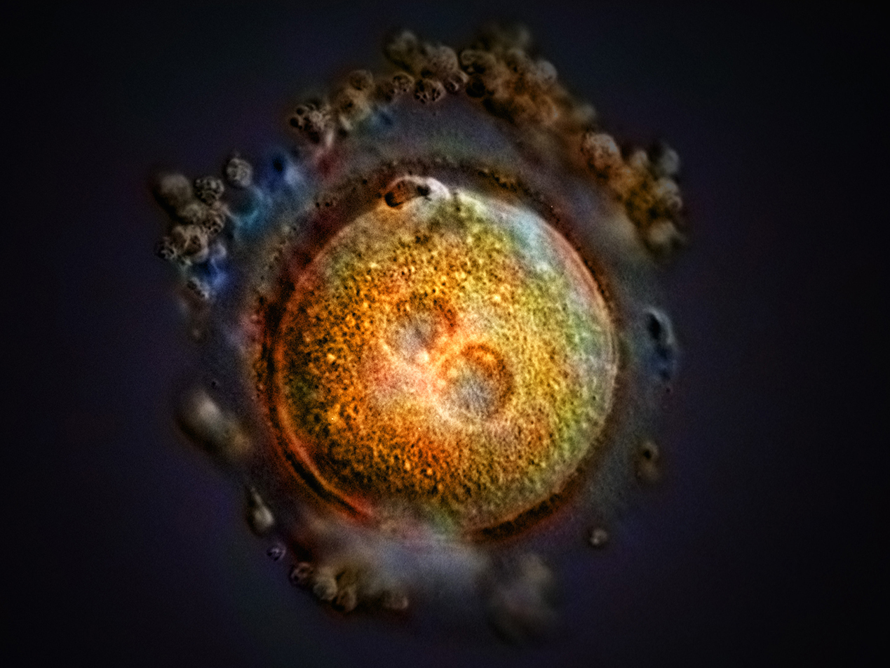 This computer-generated image shows the formation of a zygote after fertilization. Some Republican-led states, including Arkansas, Kentucky, Missouri, and Oklahoma, have passed laws declaring that life begins at fertilization, a contention that opens the door to a host of pregnancy-related litigation. (Anatomical Travelogue/Science Source)