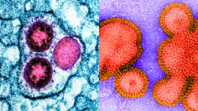 Flu is expected to flare up in U.S. this winter, raising fears of a 'twindemic'