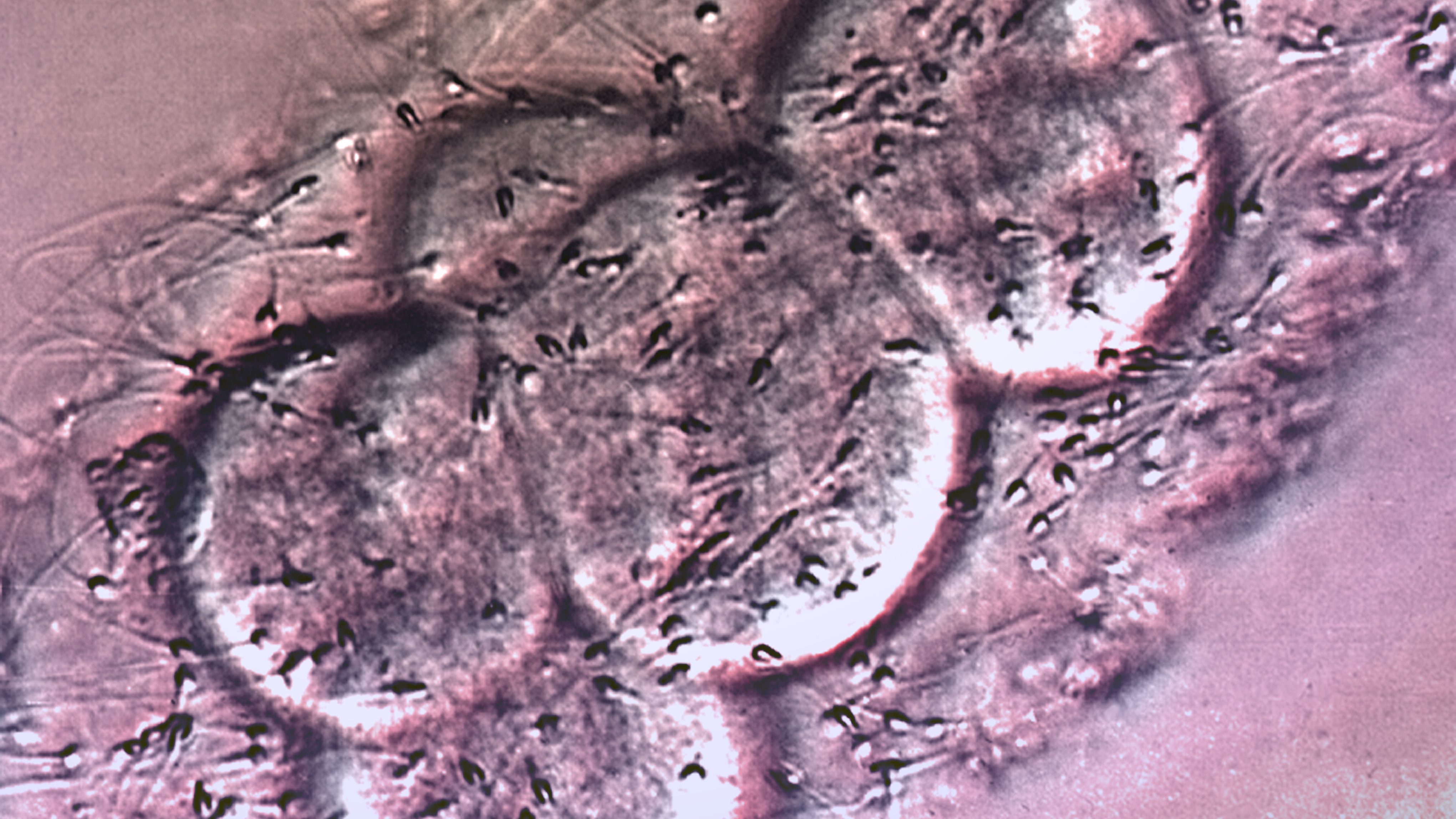 Light micrograph of human egg cells and sperm in a petri dish during in vitro fertilization. (ZEPHYR/Science Source)