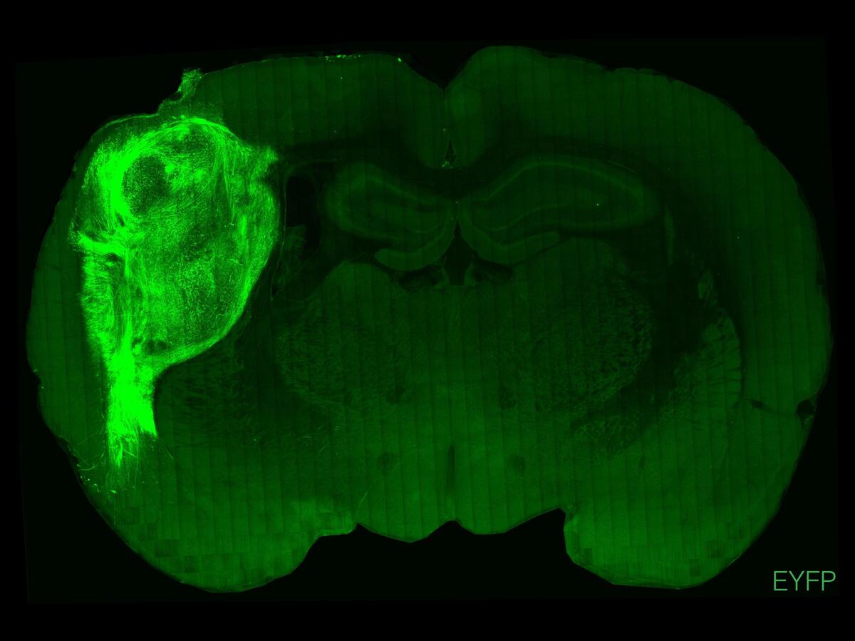 Human neuron clusters transplanted into rats offer new tool to study the brain : Shots