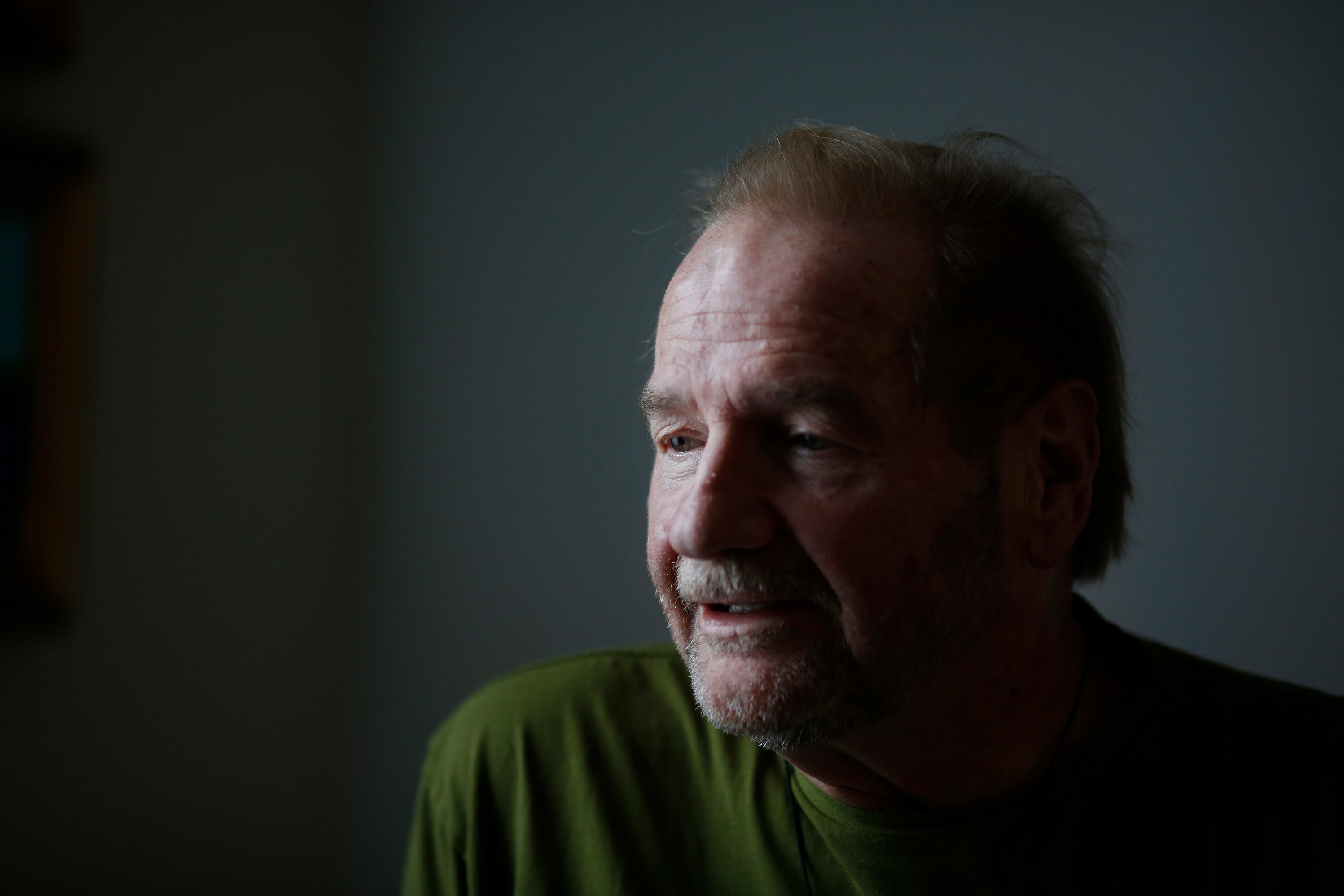 Jerry Bilinski, a retired social worker who lives in Fayetteville, N.C., says he deserves a full explanation from his medical team of what led to a small gash on his forehead during his surgery for a cataract. (Eamon Queeney for KHN)