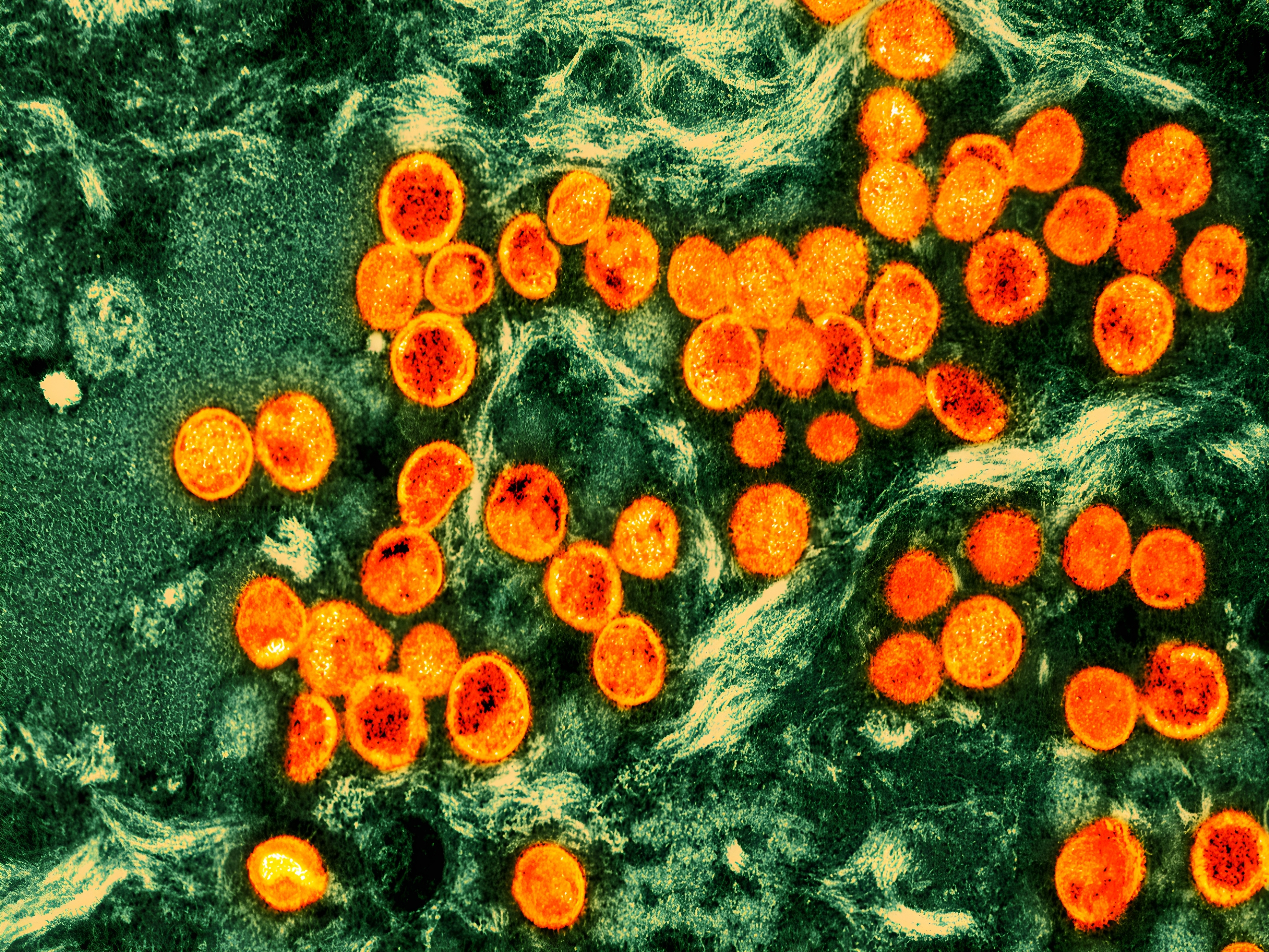 WHO renames monkeypox as mpox, citing racist stigma - capradio.org