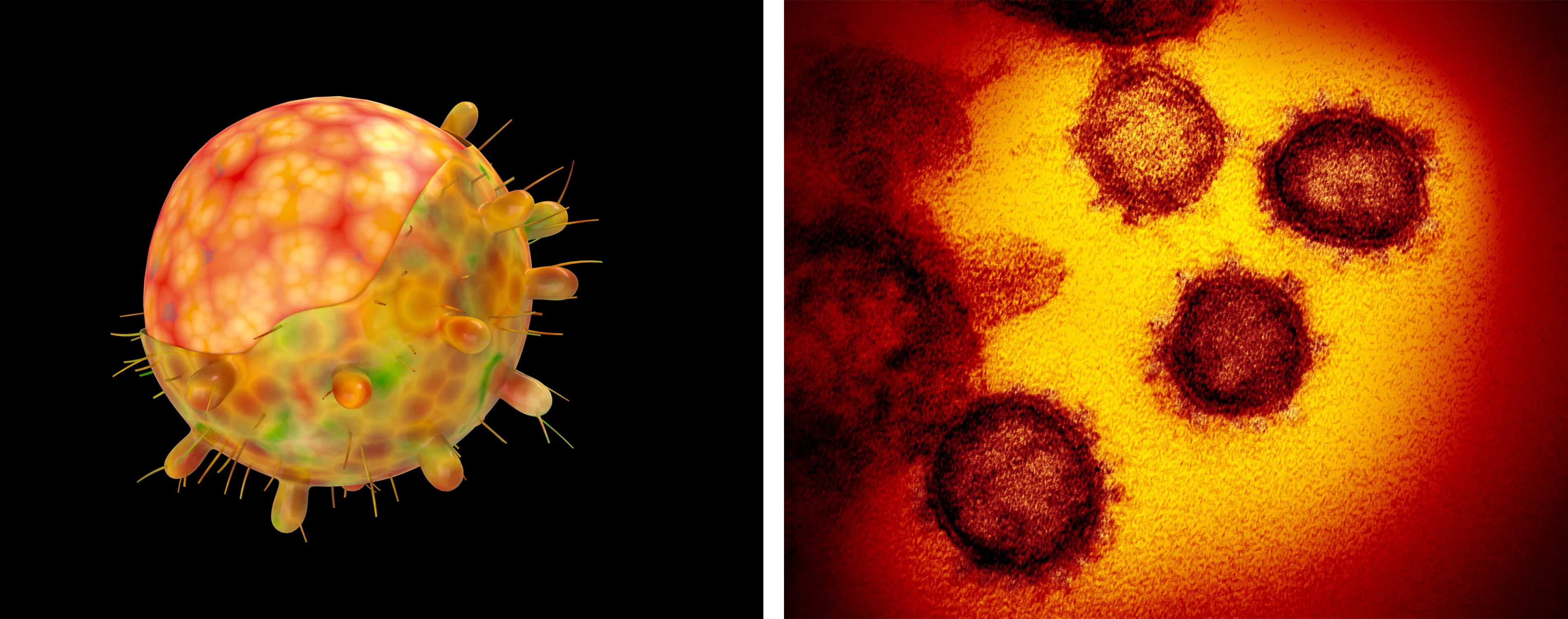 (Left) A computer-generated image of the omicron variant of the coronavirus.(Right) SARS-CoV-2 is shown in this colorized transmission electron micrograph. (Uma Shankar Sharma/Getty Images and Science Source)