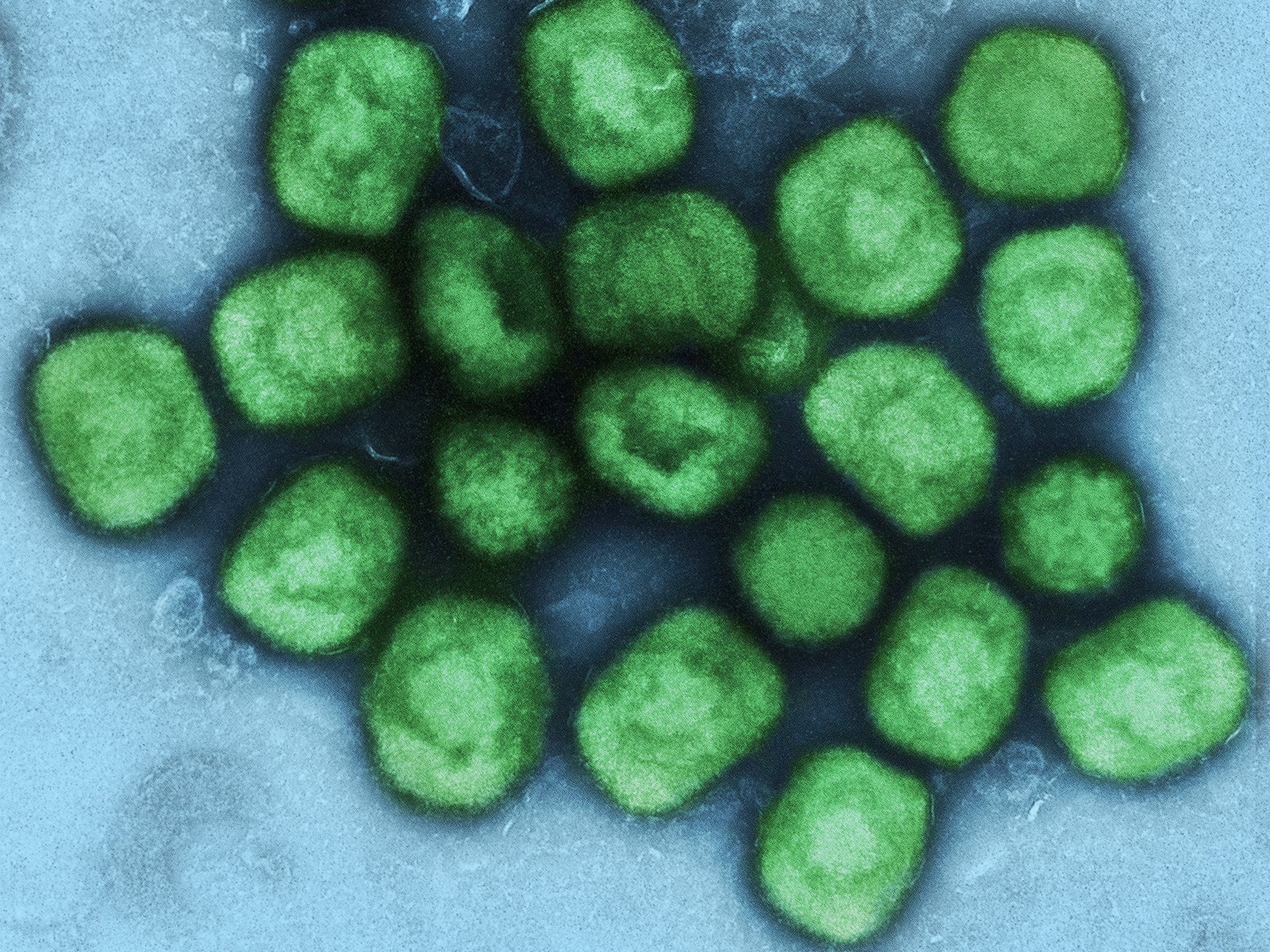 When is it OK to make germs worse in a lab? It's a more relevant question than ever