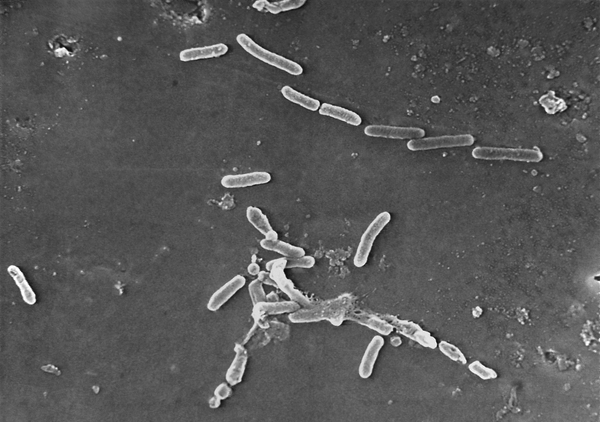 This scanning electron microscope image made available by the Centers for Disease Control and Prevention shows rod-shaped Pseudomonas aeruginosa bacteria. U.S. health officials are advising people to stop using the over-the-counter eye drops, EzriCare Artificial Tears, that have been linked to an outbreak of drug-resistant infections of Pseudomonas aeruginosa.