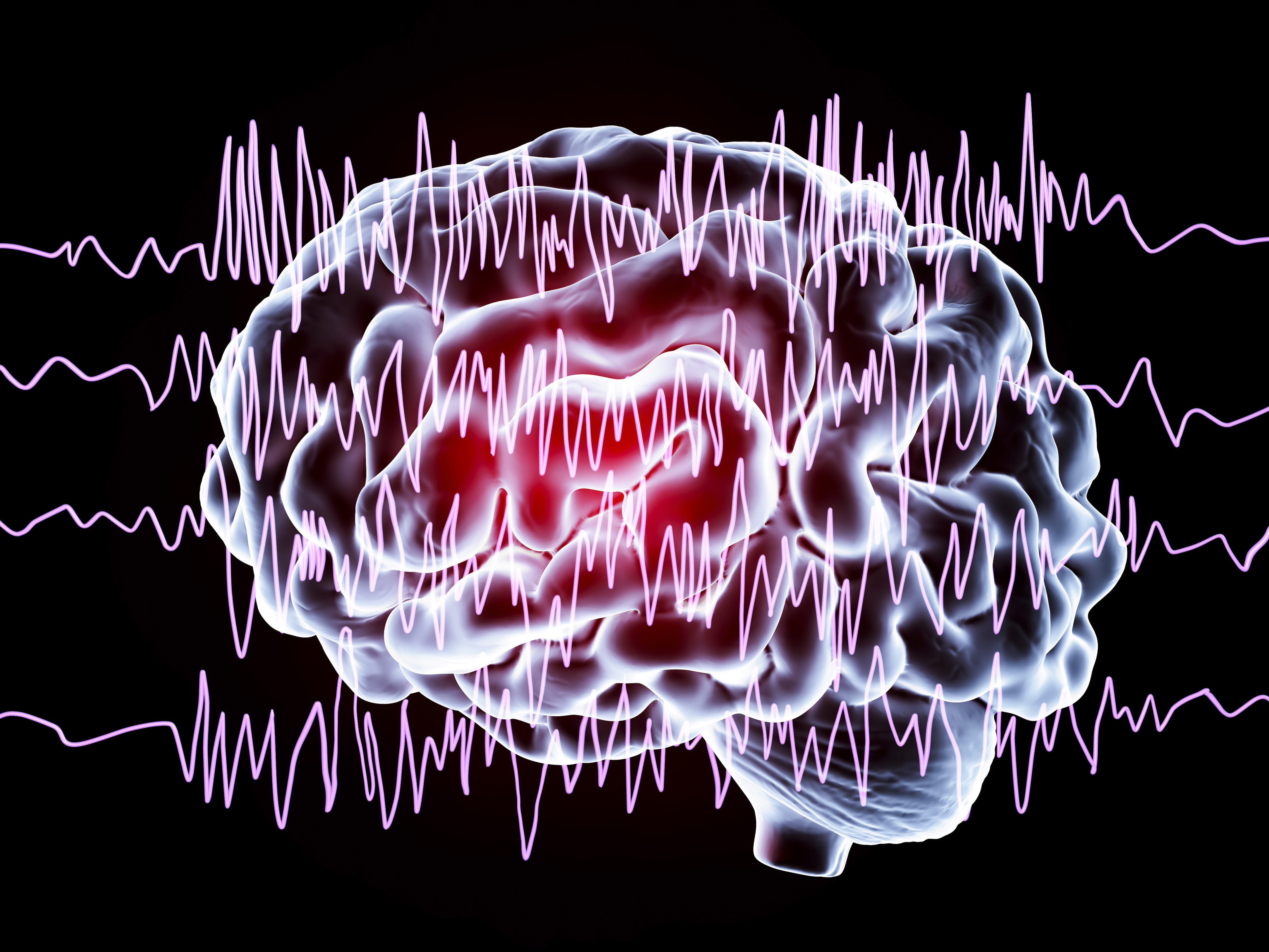 If the brain is a musical instrument, &quot;the electrophysiology is the music,&quot; says <a href=&quot;https://profiles.ucsd.edu/alexander.khalessi&quot;>Dr. Alexander Khalessi</a>. New tools to treat epilepsy patients now let doctors &quot;listen to the music a little bit better.&quot; (Getty Images)