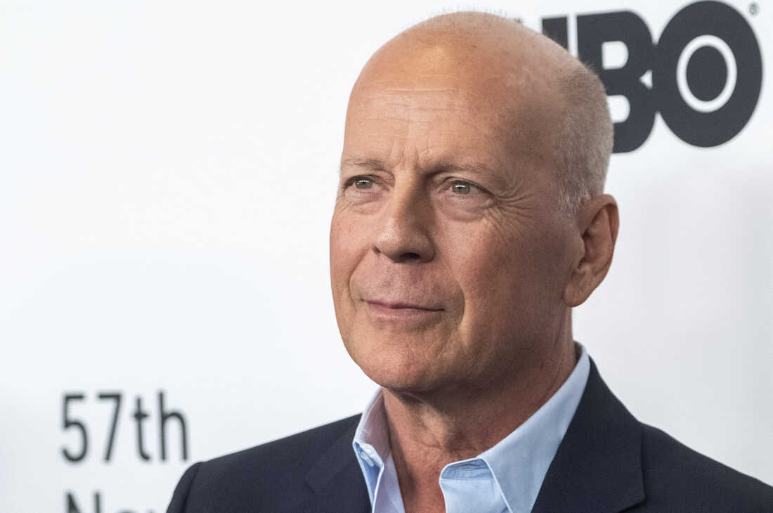 Actor Bruce Willis has frontotemporal dementia. What is it? NPR