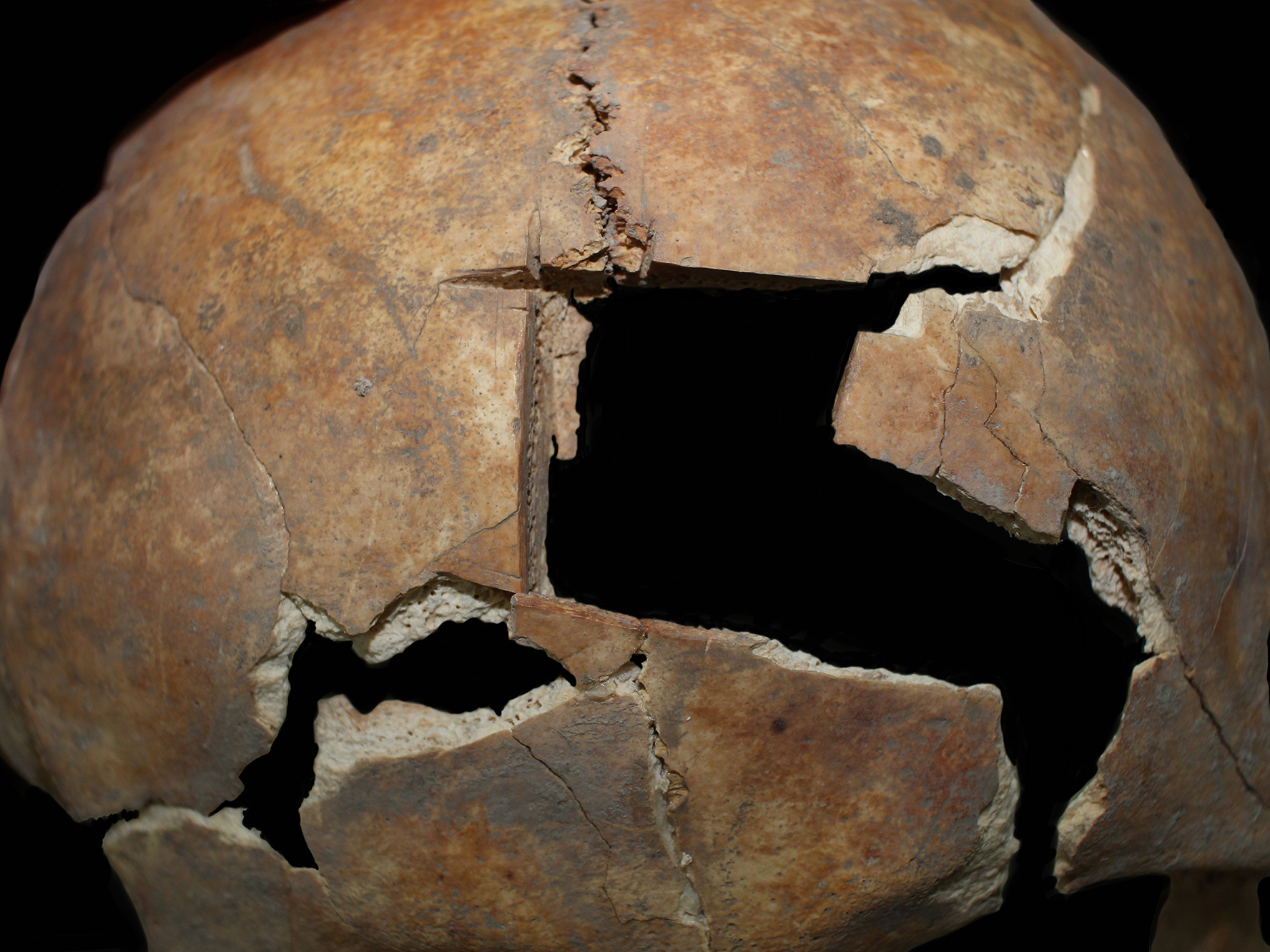 Clues to Bronze Age cranial surgery revealed in ancient bones