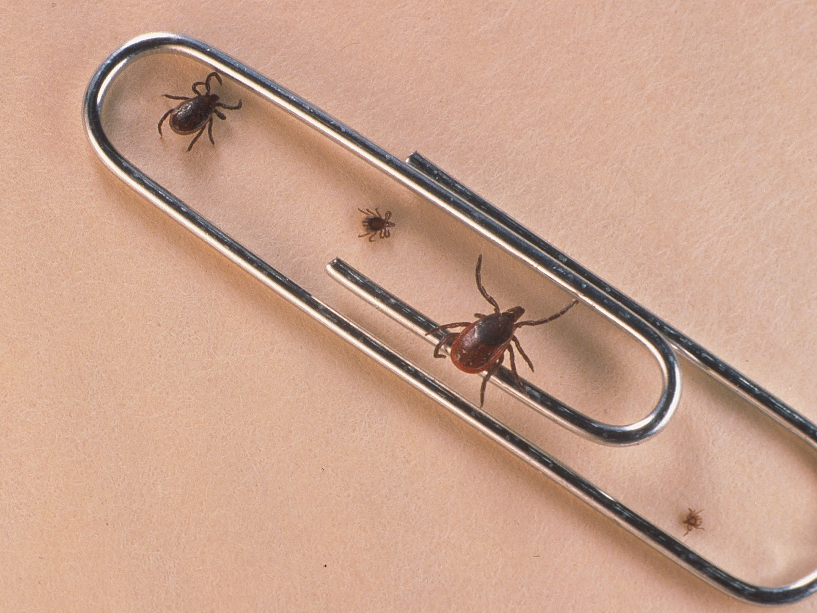 Cases of babesiosis, a tick-borne illness, are on the rise throughout the northeast, according to a new report from the Centers for Disease Control and Prevention. (Getty Images)
