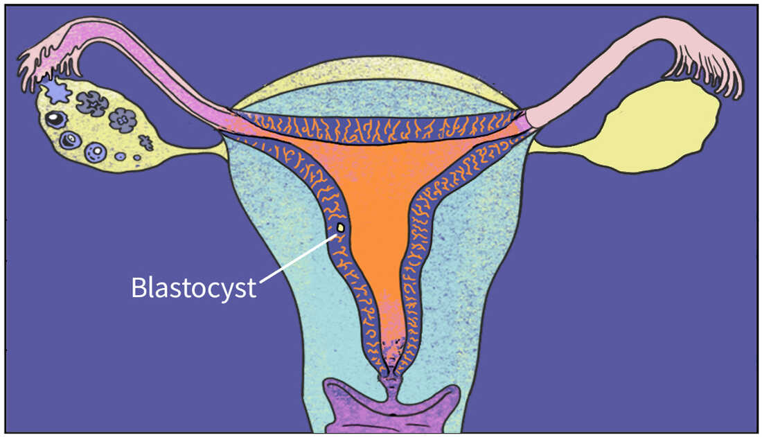 The blastocyst has been implanted. LA Johnson/NPR