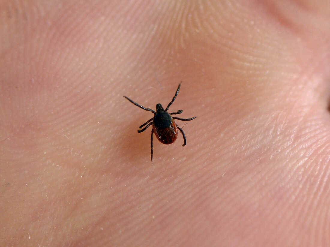 Tick Bite Pictures Symptoms What Does A Tick Bite Look, 50% OFF