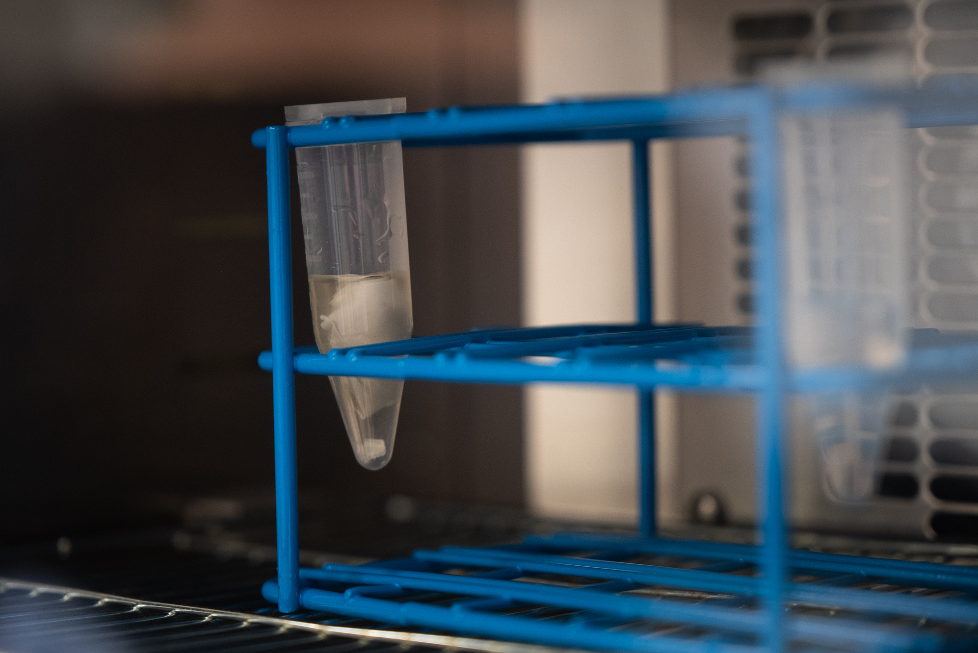 Tracking health threats, one sewage sample at a time 6 The filter soaks in a small vial as part of the process.