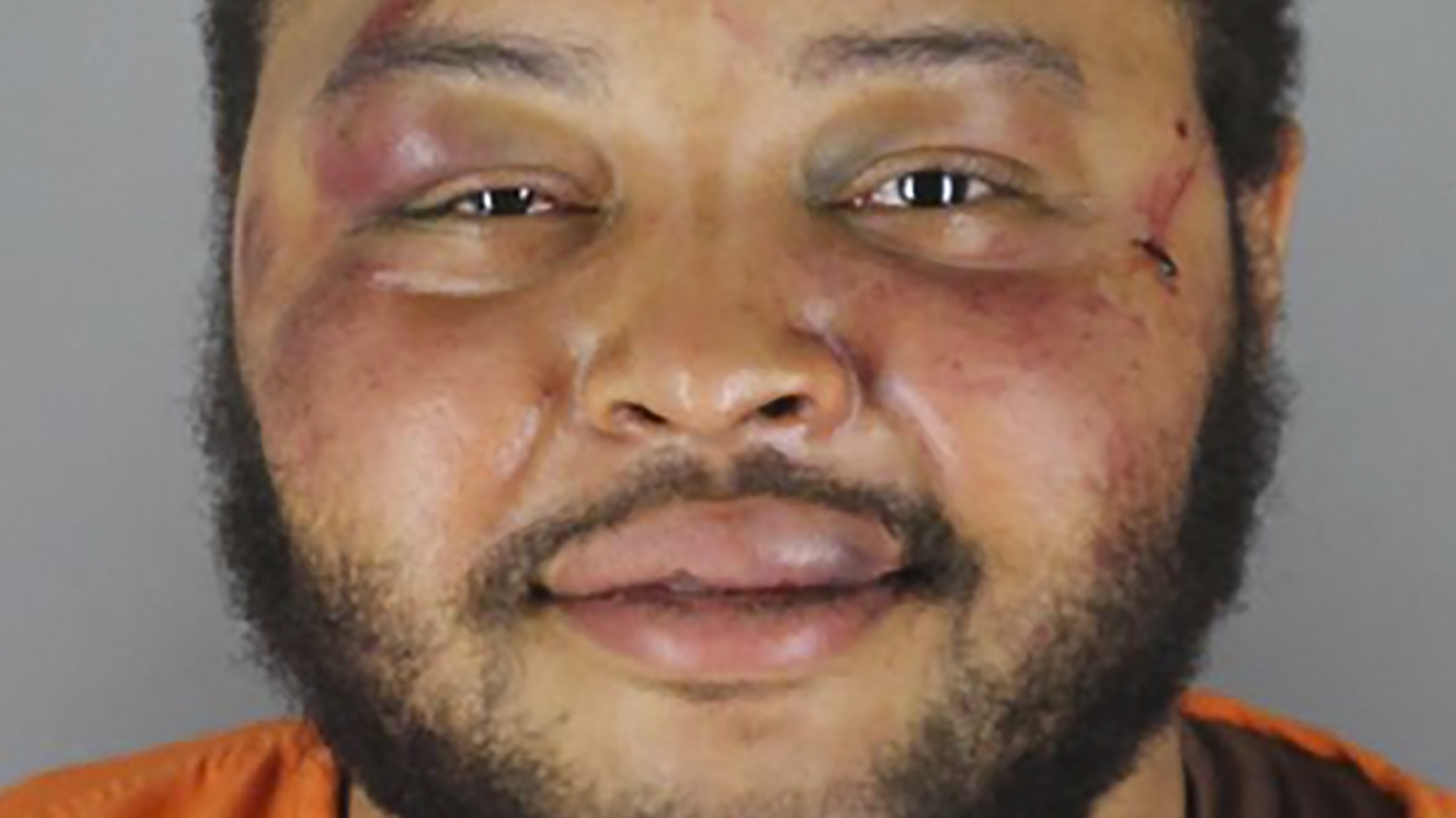 Jaleel Stallings said he fired at officers in self-defense — and after he surrendered, he was badly beaten. A former officer pleaded guilty to a felony charge in the case on Wednesday.