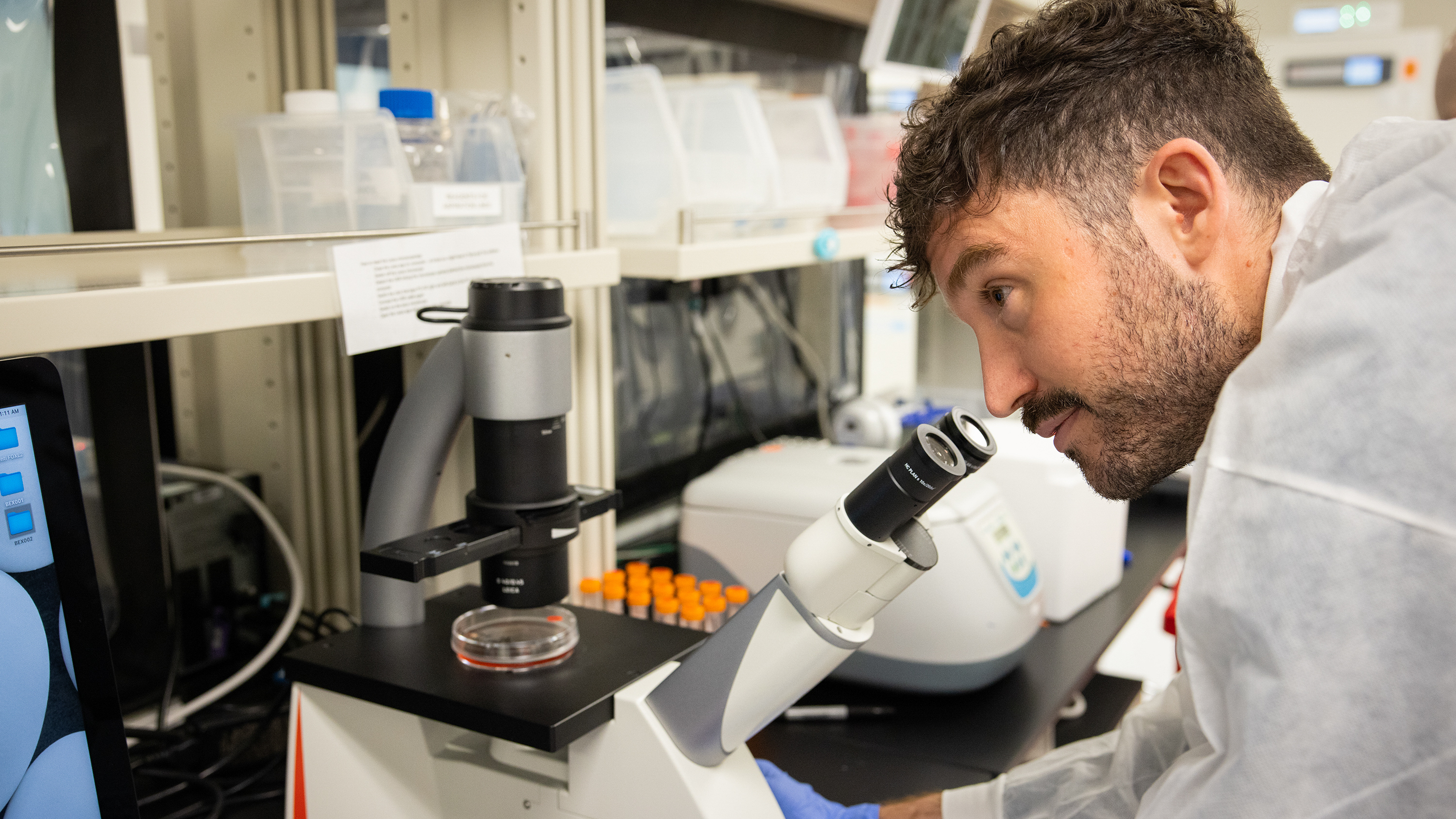 Startup aims to make lab-grown human eggs, transforming options for creating families - Vimarsana News