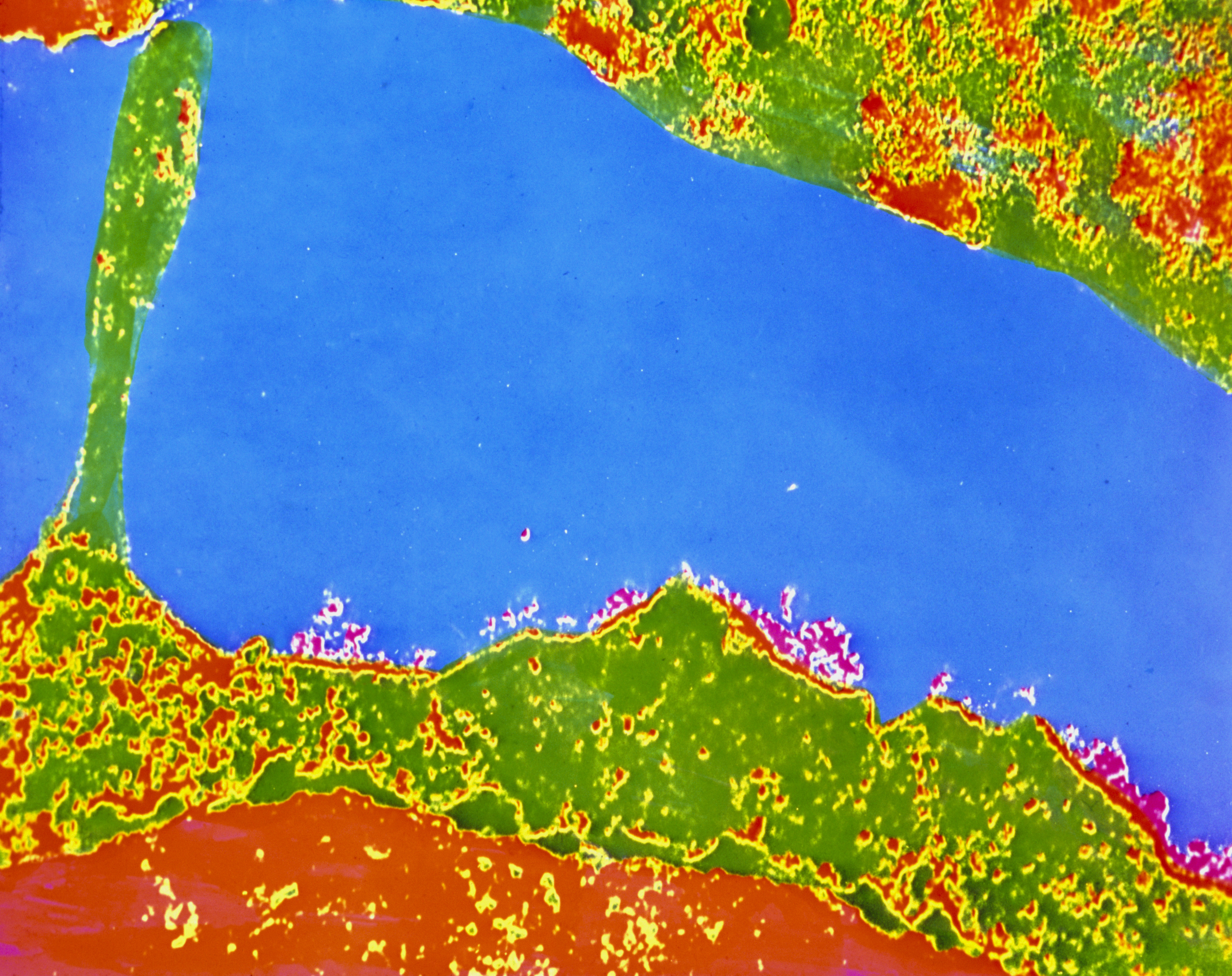 This colorized transmission electron micrograph of a human white blood cell (bottom) shows the HLA antigen — the uneven red areas on the cell's exterior surface. A variant of the HLA gene could play a role in warding off COVID symptoms. (CNRI / Science Source)
