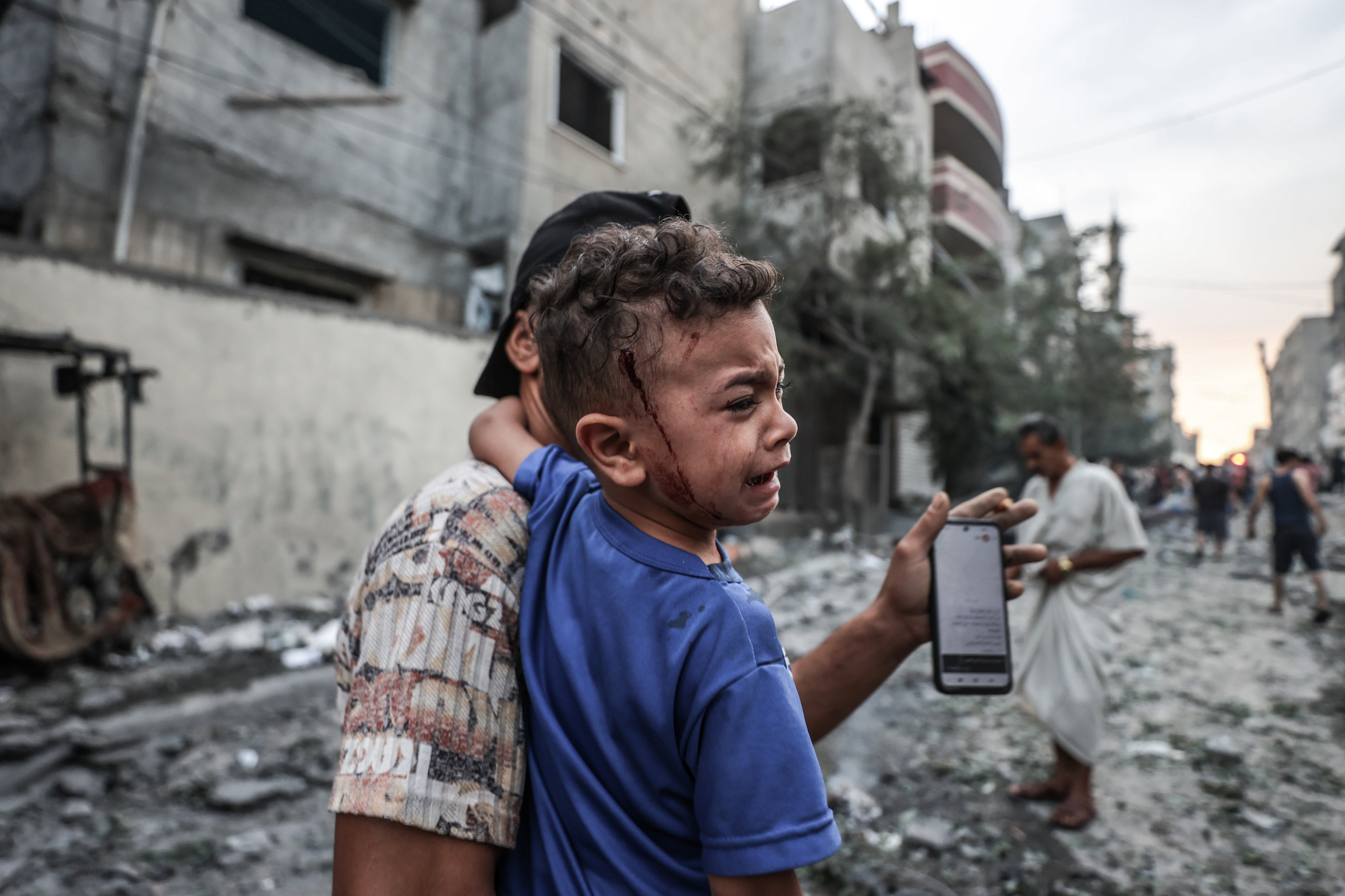 Mon., Oct. 9: An injured Palestinian kid is seen after Israeli airstrikes at al-Shati refugee camp in Gaza Strip.