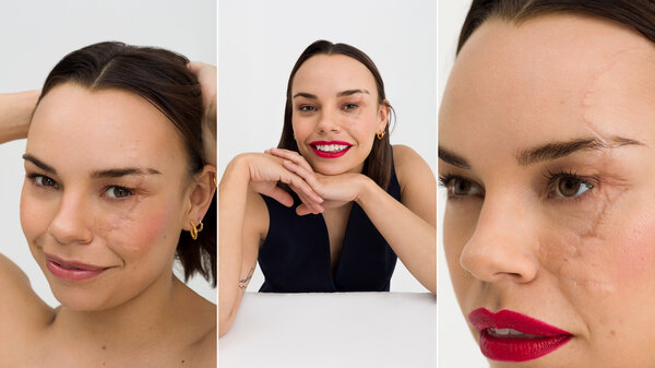 Three images side-by-side show a woman wearing red lipstick with a facial scar.