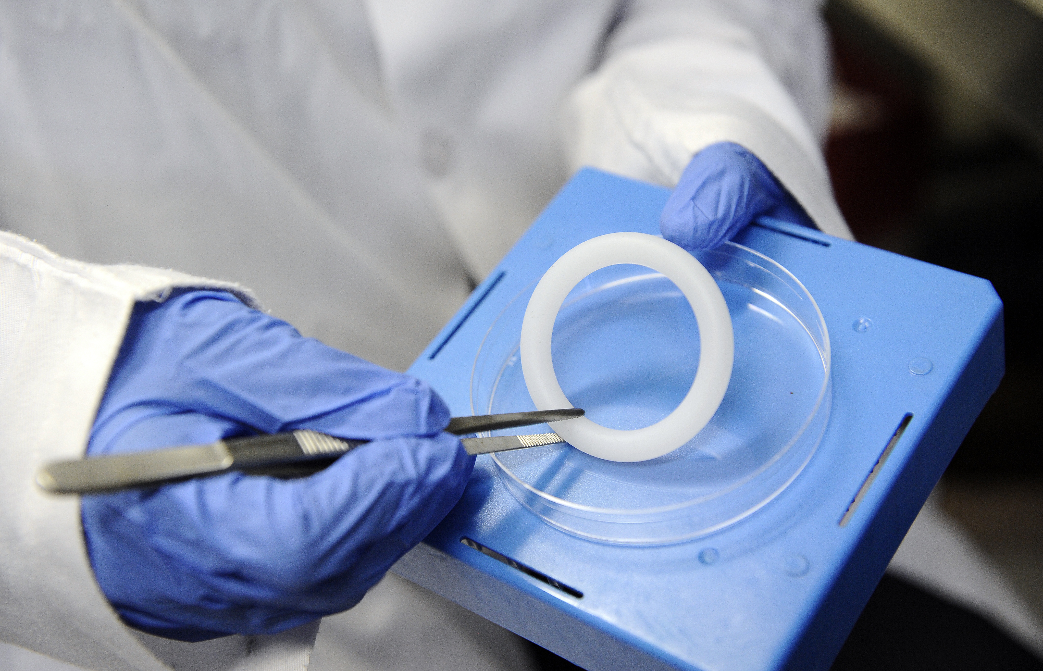 A vaginal ring that discreetly delivers anti-HIV drugs will reach more women - Vimarsana News