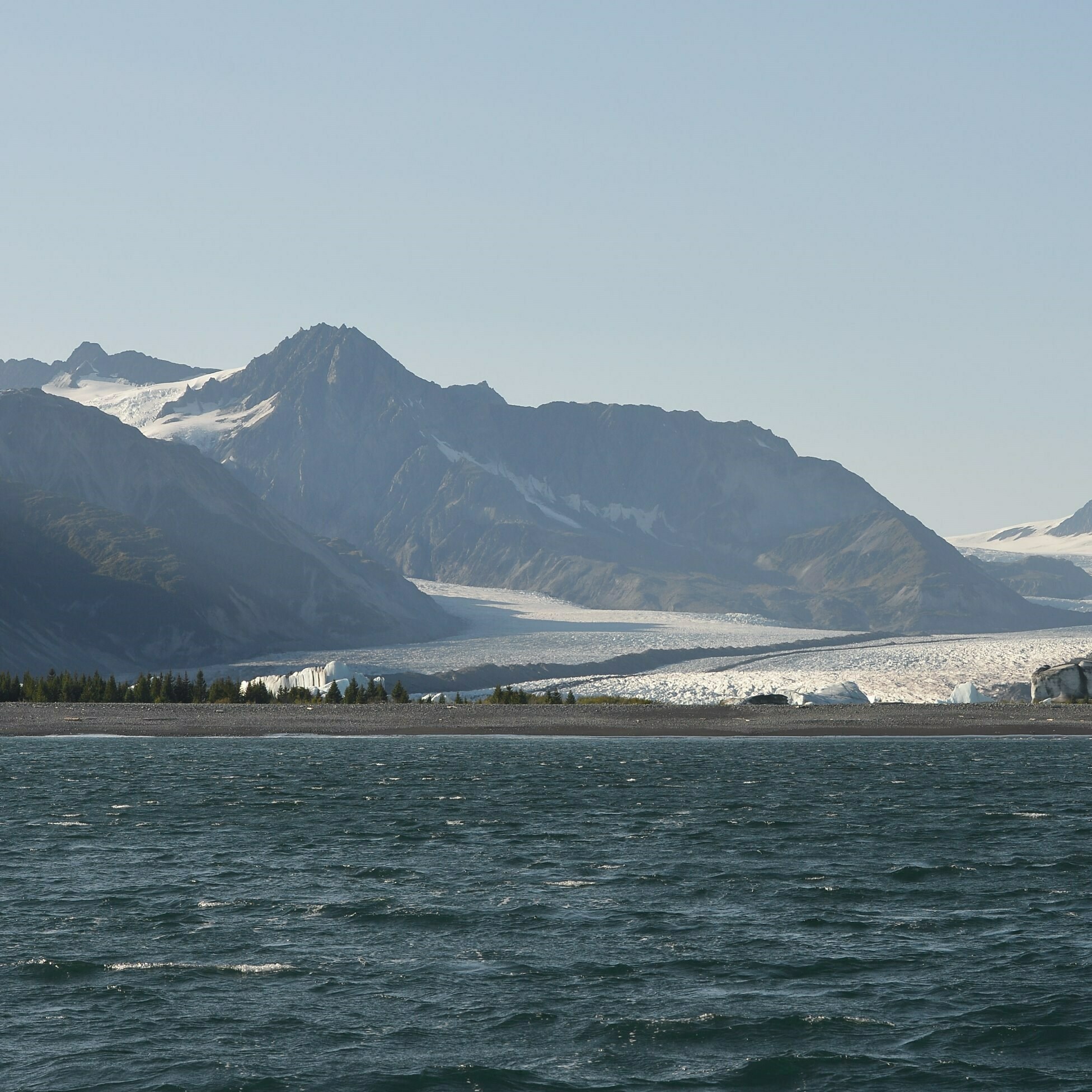 A man died from Alaskapox last month. Here's what we know about the virus - Vimarsana News